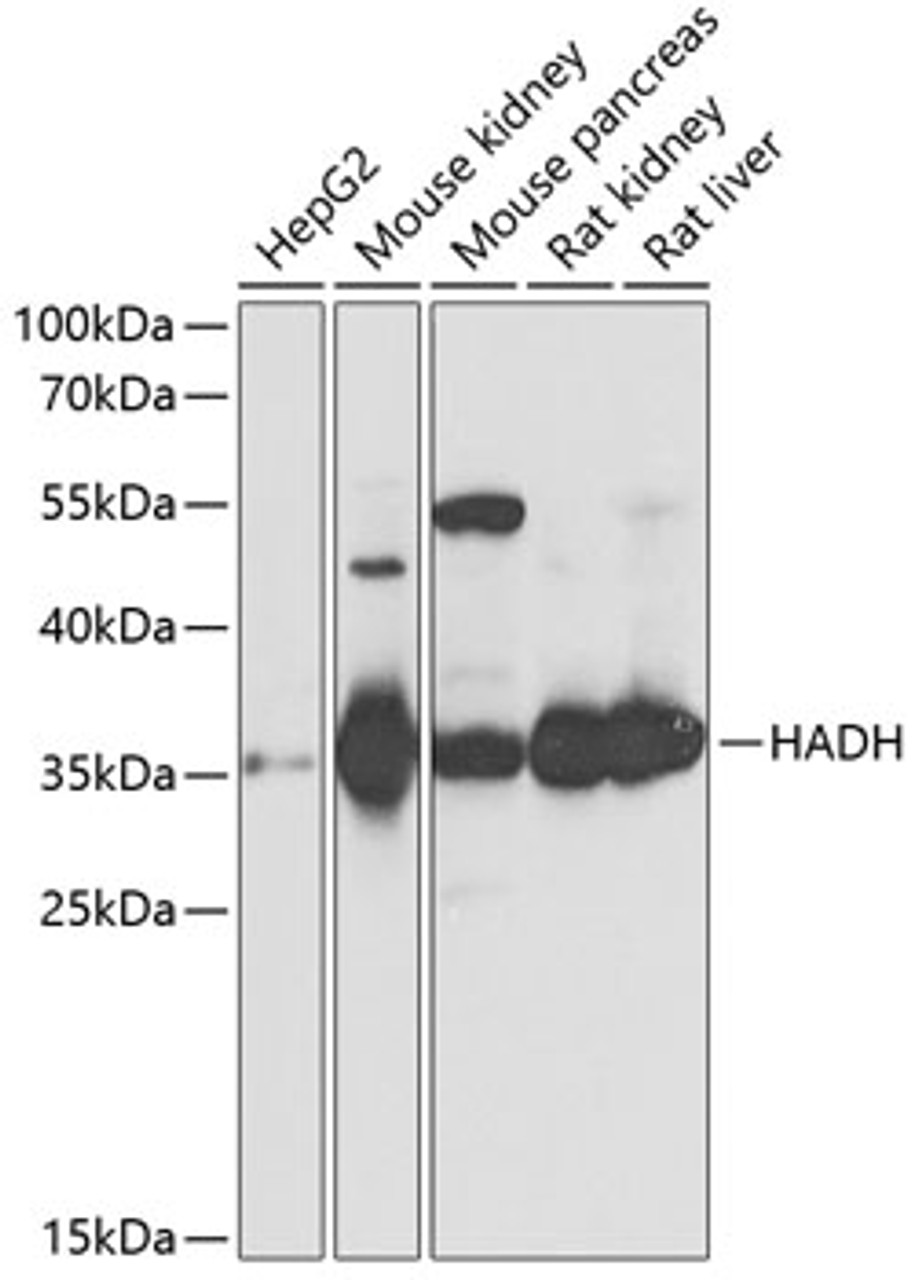 Western blot analysis of extracts of various cell lines, using HADH antibody (13-787) at 1:1000 dilution.<br/>Secondary antibody: HRP Goat Anti-Rabbit IgG (H+L) at 1:10000 dilution.<br/>Lysates/proteins: 25ug per lane.<br/>Blocking buffer: 3% nonfat dry milk in TBST.<br/>Detection: ECL Basic Kit.<br/>Exposure time: 5s.