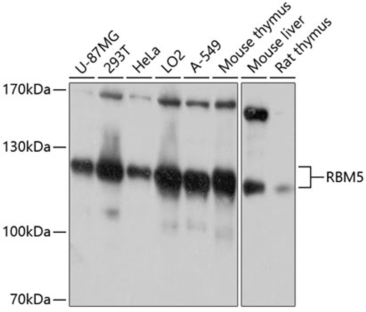 Western blot analysis of extracts of various cell lines, using RBM5 antibody (13-803) at 1:1000 dilution.<br/>Secondary antibody: HRP Goat Anti-Rabbit IgG (H+L) at 1:10000 dilution.<br/>Lysates/proteins: 25ug per lane.<br/>Blocking buffer: 3% nonfat dry milk in TBST.<br/>Detection: ECL Basic Kit.<br/>Exposure time: 30s.