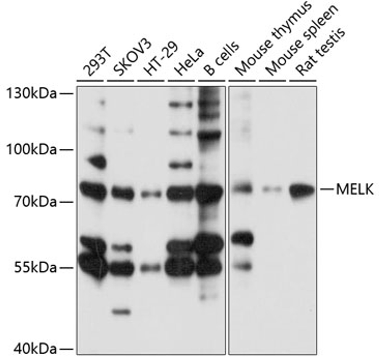 Western blot analysis of extracts of various cell lines, using MELK antibody (13-806) at 1:1000 dilution.<br/>Secondary antibody: HRP Goat Anti-Rabbit IgG (H+L) at 1:10000 dilution.<br/>Lysates/proteins: 25ug per lane.<br/>Blocking buffer: 3% nonfat dry milk in TBST.<br/>Detection: ECL Basic Kit.<br/>Exposure time: 5s.