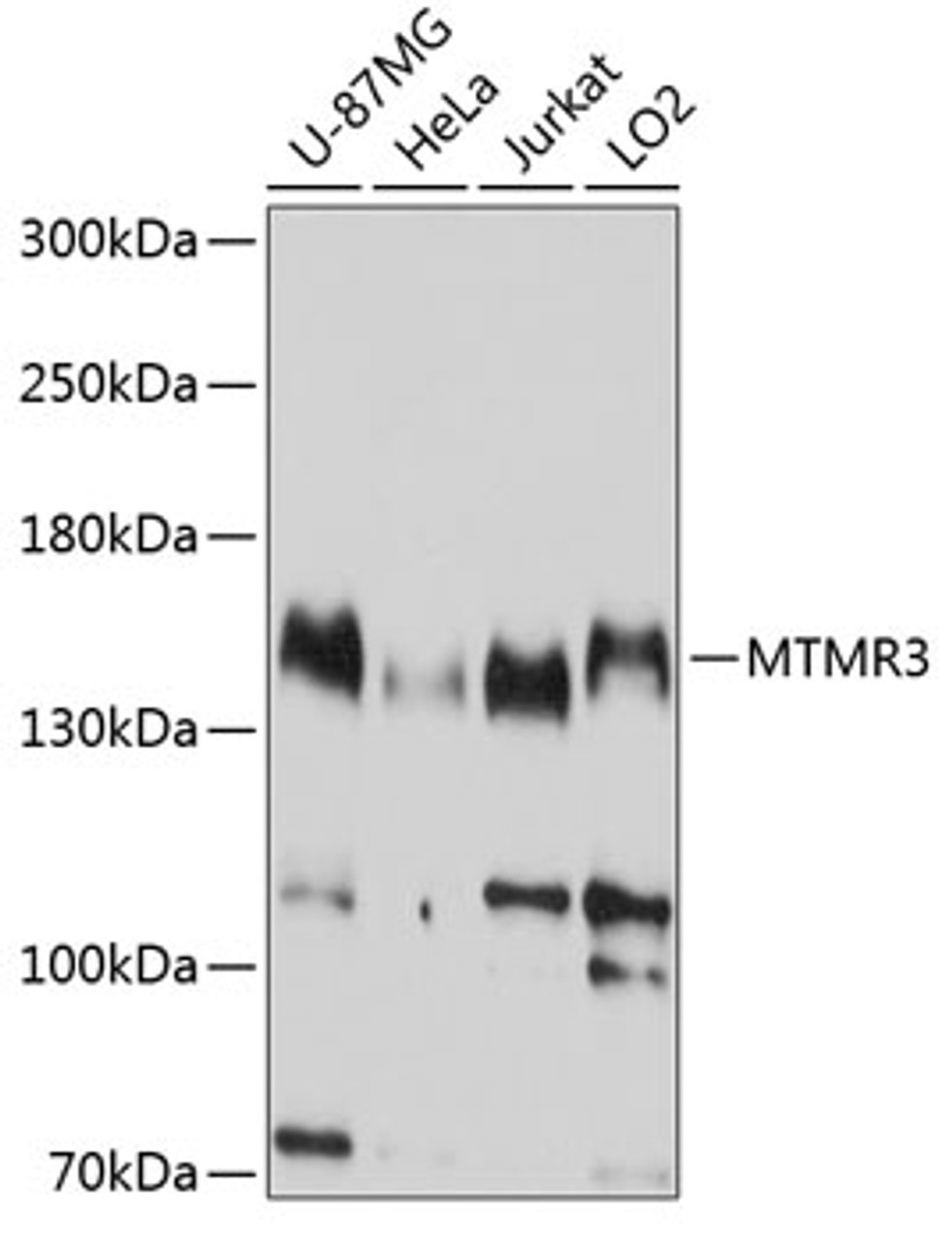Western blot analysis of extracts of various cell lines, using MTMR3 antibody (13-808) at 1:1000 dilution.<br/>Secondary antibody: HRP Goat Anti-Rabbit IgG (H+L) at 1:10000 dilution.<br/>Lysates/proteins: 25ug per lane.<br/>Blocking buffer: 3% nonfat dry milk in TBST.<br/>Detection: ECL Basic Kit.<br/>Exposure time: 10s.