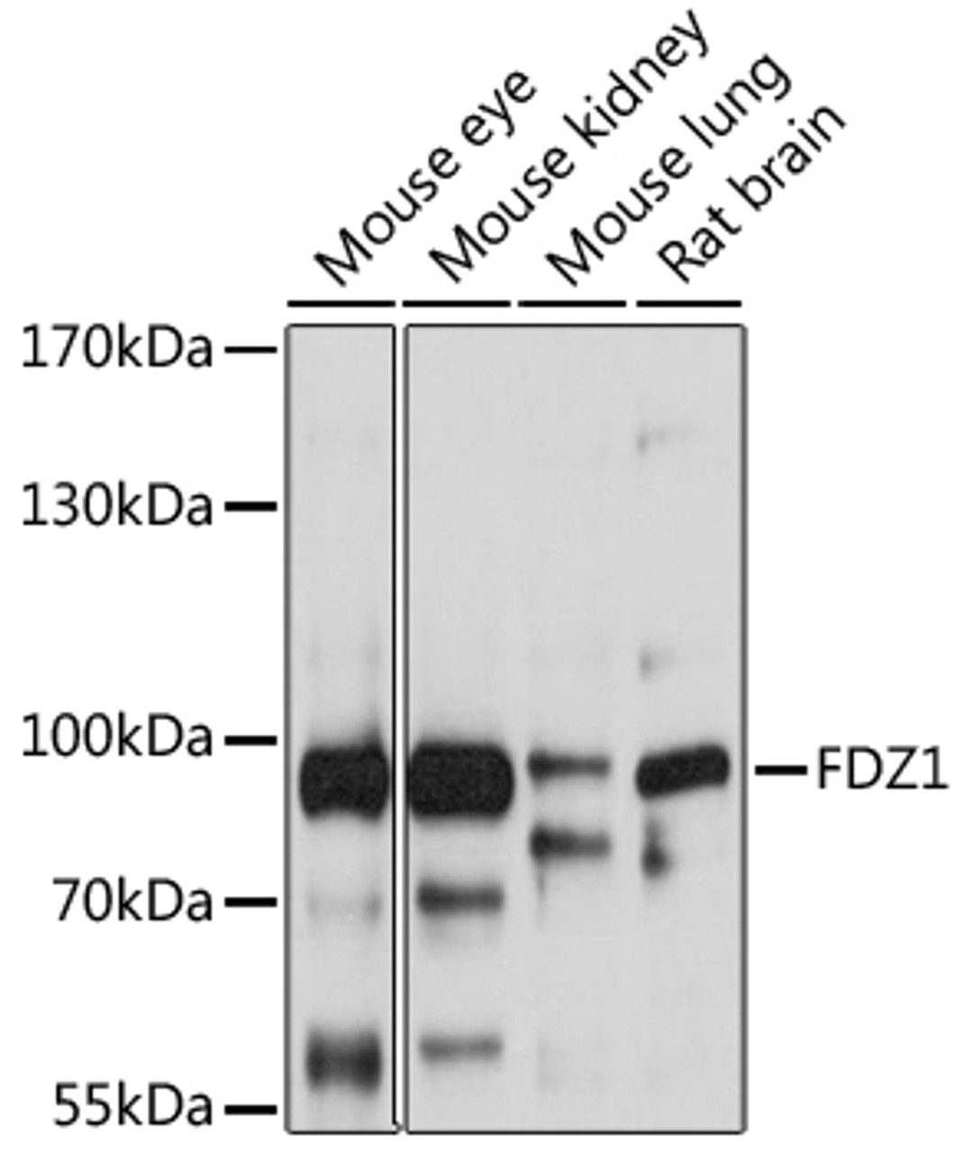 Western blot analysis of extracts of various cell lines, using FZD1 antibody (13-809) at 1:1000 dilution.<br/>Secondary antibody: HRP Goat Anti-Rabbit IgG (H+L) at 1:10000 dilution.<br/>Lysates/proteins: 25ug per lane.<br/>Blocking buffer: 3% nonfat dry milk in TBST.<br/>Detection: ECL Basic Kit.<br/>Exposure time: 1s.