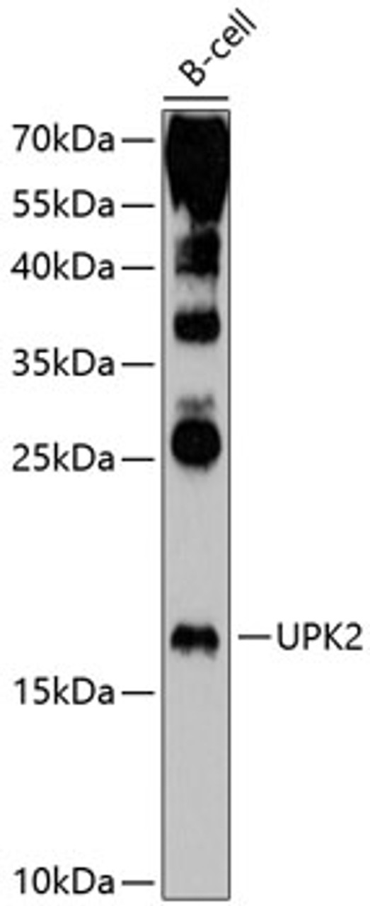 Western blot analysis of extracts of B-cell cells, using UPK2 antibody (13-812) at 1:1000 dilution.<br/>Secondary antibody: HRP Goat Anti-Rabbit IgG (H+L) at 1:10000 dilution.<br/>Lysates/proteins: 25ug per lane.<br/>Blocking buffer: 3% nonfat dry milk in TBST.<br/>Detection: ECL Enhanced Kit.<br/>Exposure time: 40s.