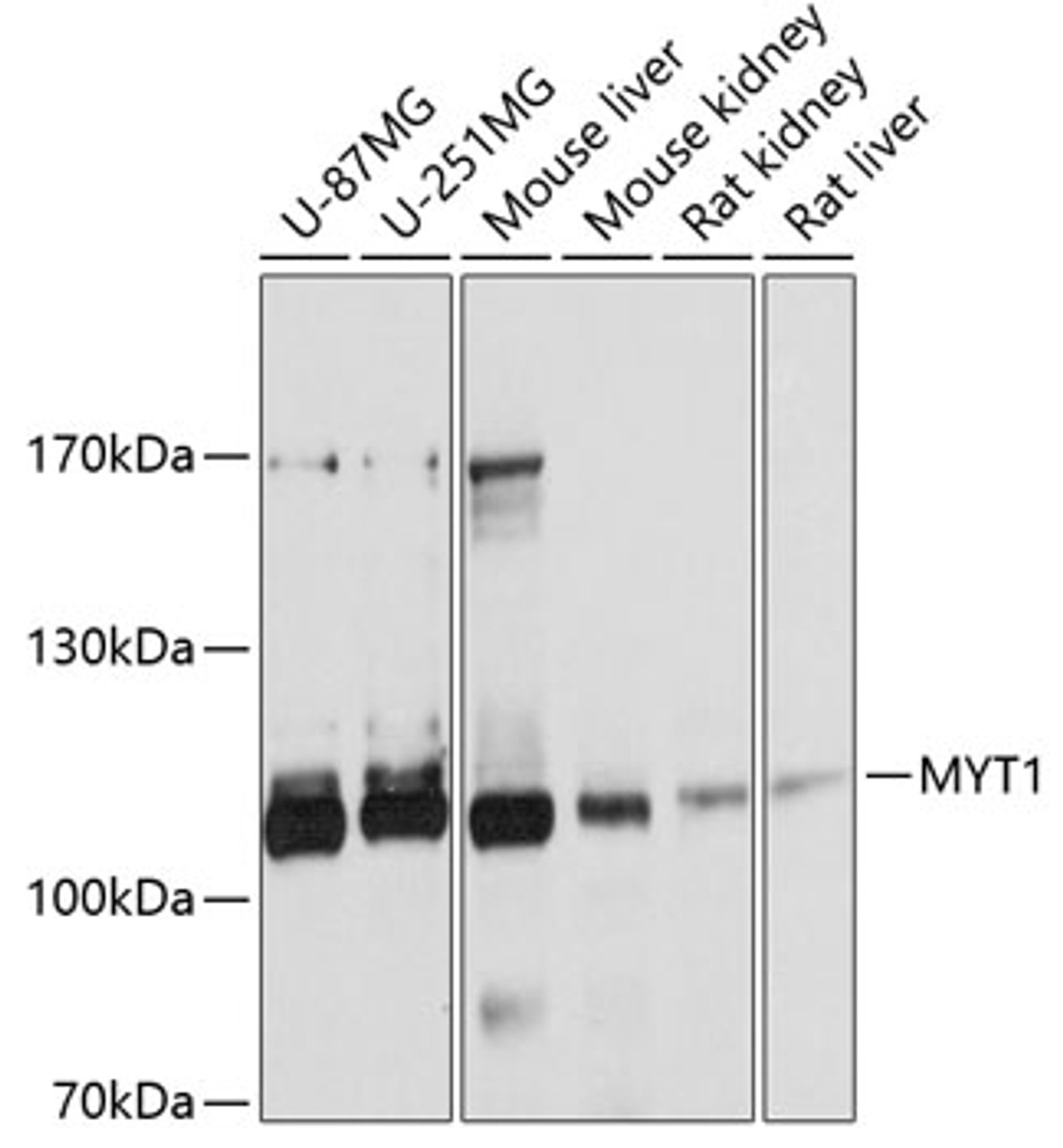 Western blot analysis of extracts of various cell lines, using MYT1 antibody (13-820) at 1:1000 dilution.<br/>Secondary antibody: HRP Goat Anti-Rabbit IgG (H+L) at 1:10000 dilution.<br/>Lysates/proteins: 25ug per lane.<br/>Blocking buffer: 3% nonfat dry milk in TBST.<br/>Detection: ECL Basic Kit.<br/>Exposure time: 5s.