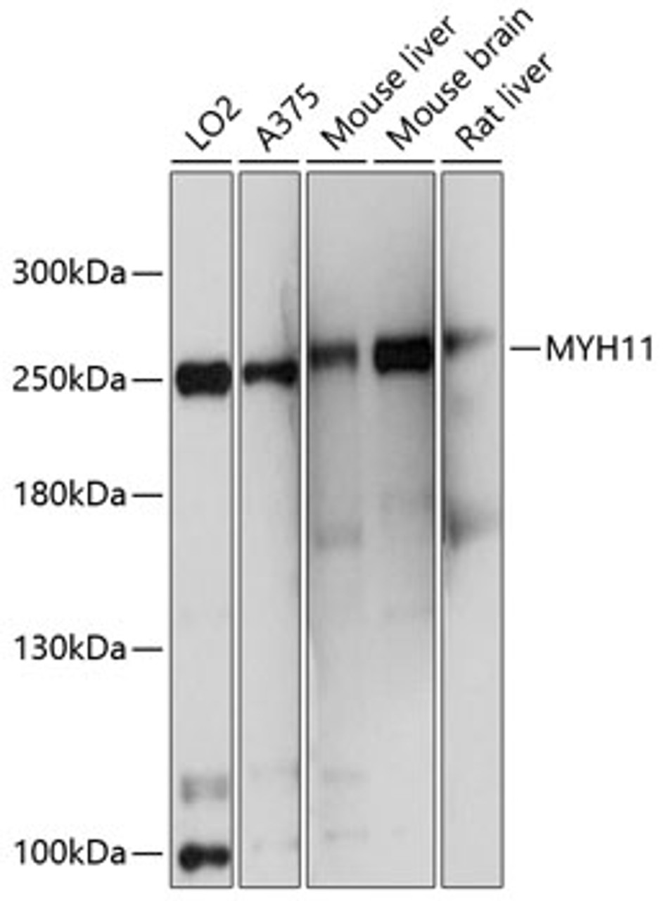 Western blot analysis of extracts of various cell lines, using MYH11 antibody (13-822) at 1:1000 dilution.<br/>Secondary antibody: HRP Goat Anti-Rabbit IgG (H+L) at 1:10000 dilution.<br/>Lysates/proteins: 25ug per lane.<br/>Blocking buffer: 3% nonfat dry milk in TBST.<br/>Detection: ECL Basic Kit.<br/>Exposure time: 5s.