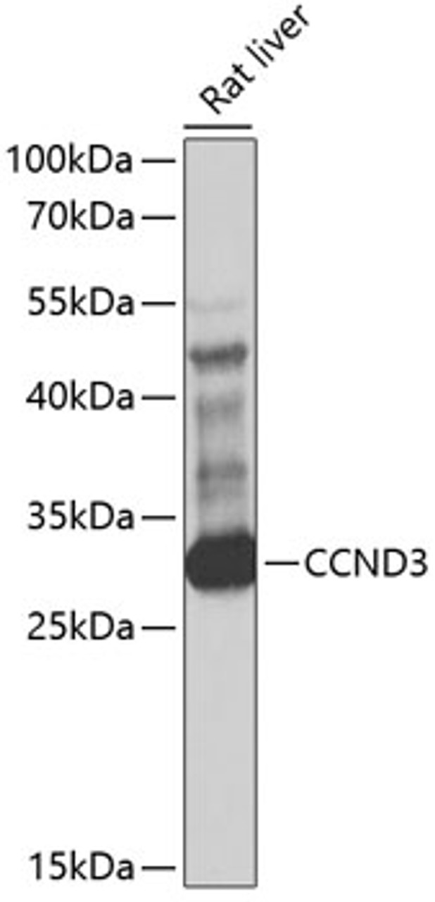 Western blot analysis of extracts of rat liver, using CCND3 antibody (13-830) at 1:1000 dilution.<br/>Secondary antibody: HRP Goat Anti-Rabbit IgG (H+L) at 1:10000 dilution.<br/>Lysates/proteins: 25ug per lane.<br/>Blocking buffer: 3% nonfat dry milk in TBST.<br/>Detection: ECL Basic Kit.<br/>Exposure time: 10s.