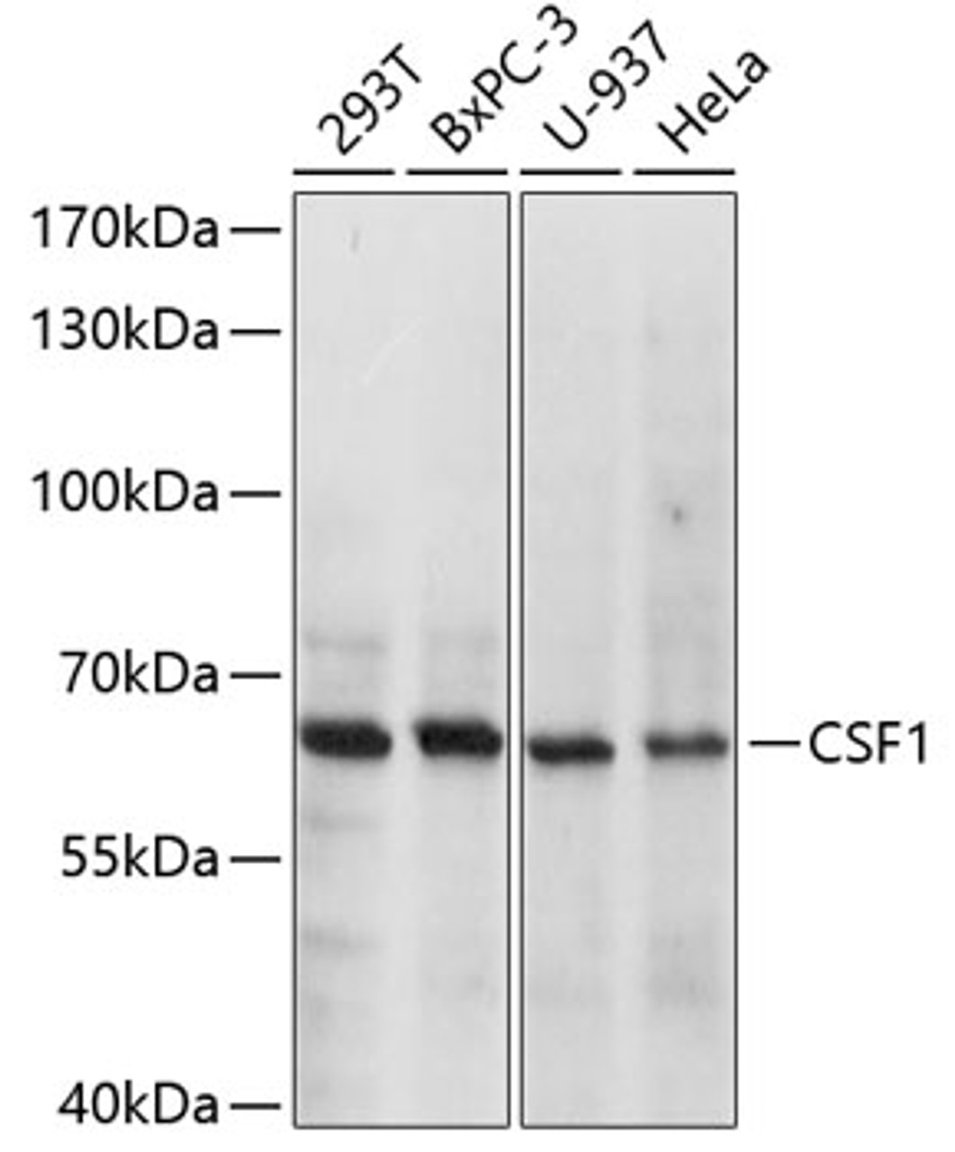 Western blot analysis of extracts of various cell lines, using CSF1 antibody (13-836) at 1:1000 dilution.<br/>Secondary antibody: HRP Goat Anti-Rabbit IgG (H+L) at 1:10000 dilution.<br/>Lysates/proteins: 25ug per lane.<br/>Blocking buffer: 3% nonfat dry milk in TBST.<br/>Detection: ECL Basic Kit.<br/>Exposure time: 5s.