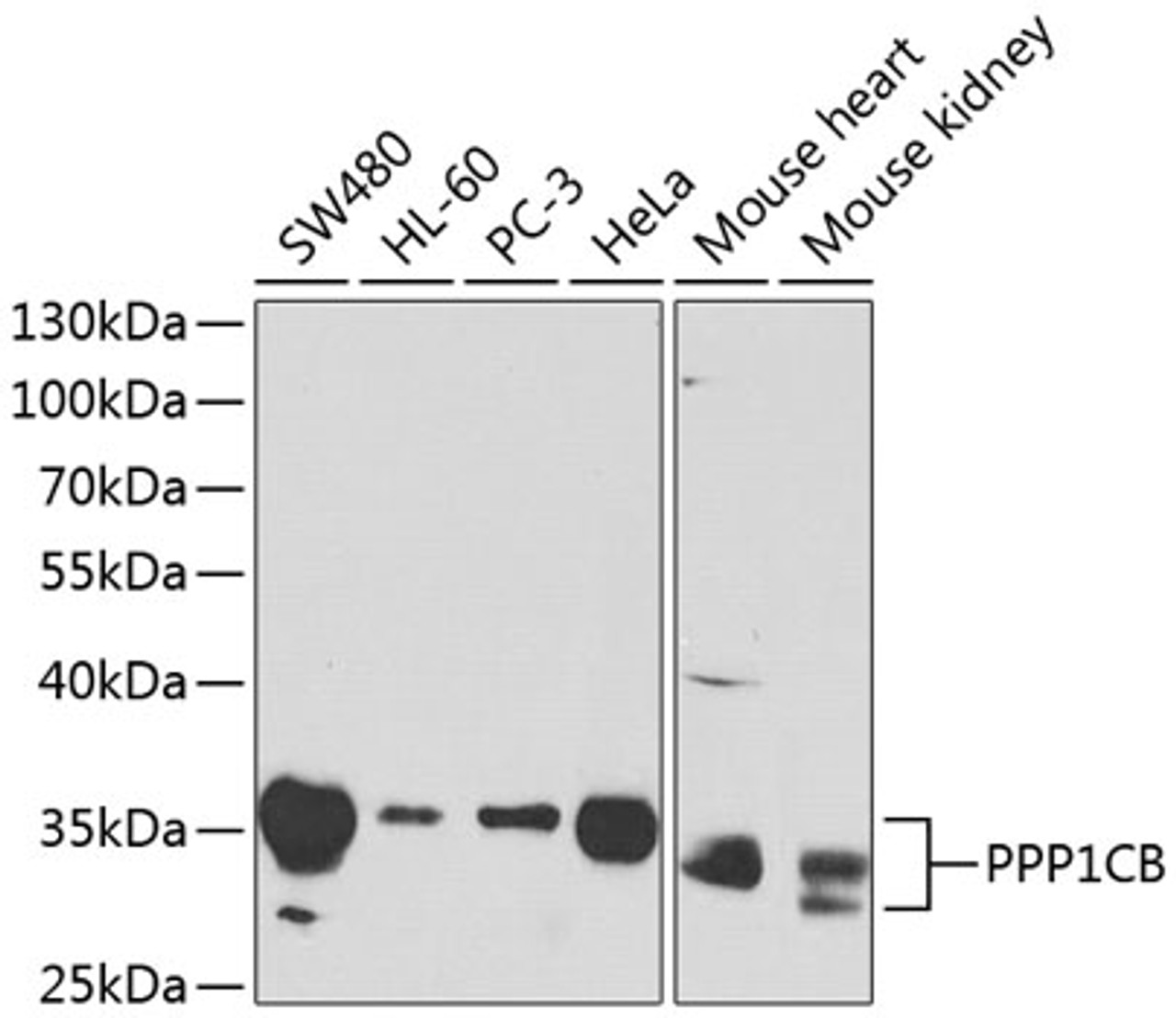 Western blot analysis of extracts of various cell lines, using PPP1CB antibody (13-846) at 1:1000 dilution.<br/>Secondary antibody: HRP Goat Anti-Rabbit IgG (H+L) at 1:10000 dilution.<br/>Lysates/proteins: 25ug per lane.<br/>Blocking buffer: 3% nonfat dry milk in TBST.