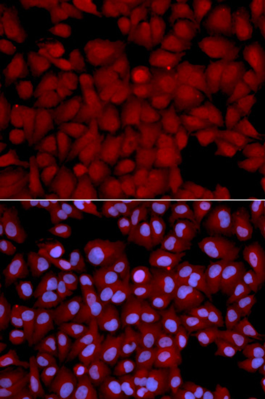 Immunofluorescence analysis of U2OS cells using PPP1CB antibody (13-846) . Blue: DAPI for nuclear staining.