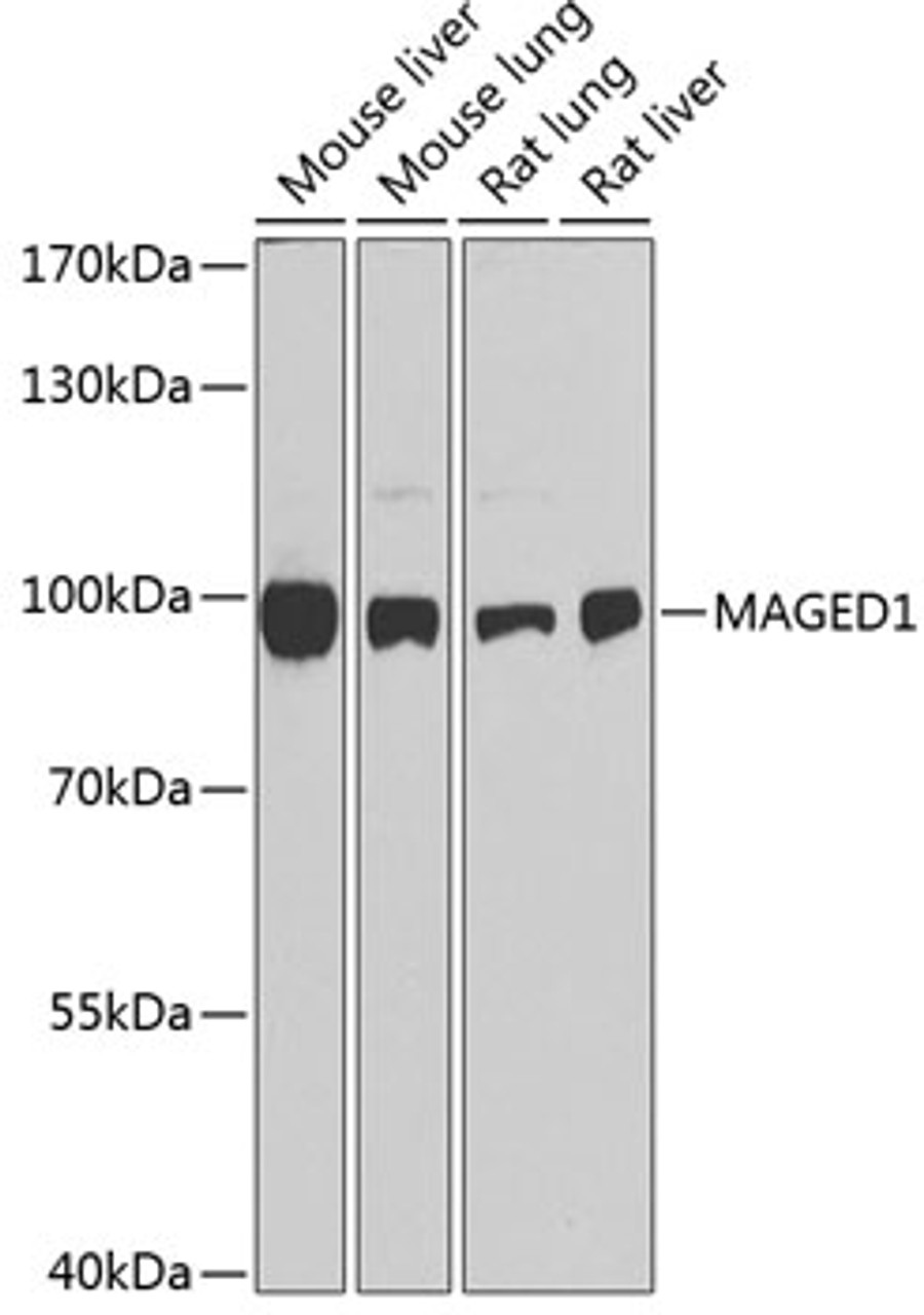 Western blot analysis of extracts of various cell lines, using MAGED1 antibody (13-858) at 1:1000 dilution.<br/>Secondary antibody: HRP Goat Anti-Rabbit IgG (H+L) at 1:10000 dilution.<br/>Lysates/proteins: 25ug per lane.<br/>Blocking buffer: 3% nonfat dry milk in TBST.<br/>Detection: ECL Basic Kit.<br/>Exposure time: 90s.