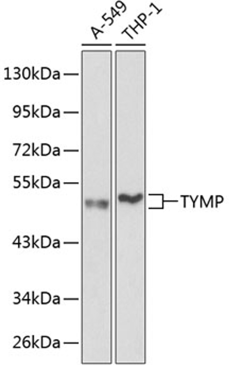 Western blot analysis of extracts of various cell lines, using TYMP antibody (13-864) at 1:1000 dilution.<br/>Secondary antibody: HRP Goat Anti-Rabbit IgG (H+L) at 1:10000 dilution.<br/>Lysates/proteins: 25ug per lane.<br/>Blocking buffer: 3% nonfat dry milk in TBST.