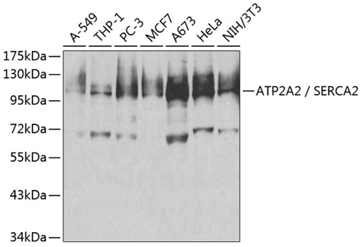 Western blot analysis of extracts of various cell lines, using ATP2A2 / SERCA2 antibody (13-873) at 1:500 dilution.<br/>Secondary antibody: HRP Goat Anti-Rabbit IgG (H+L) at 1:10000 dilution.<br/>Lysates/proteins: 25ug per lane.<br/>Blocking buffer: 3% nonfat dry milk in TBST.