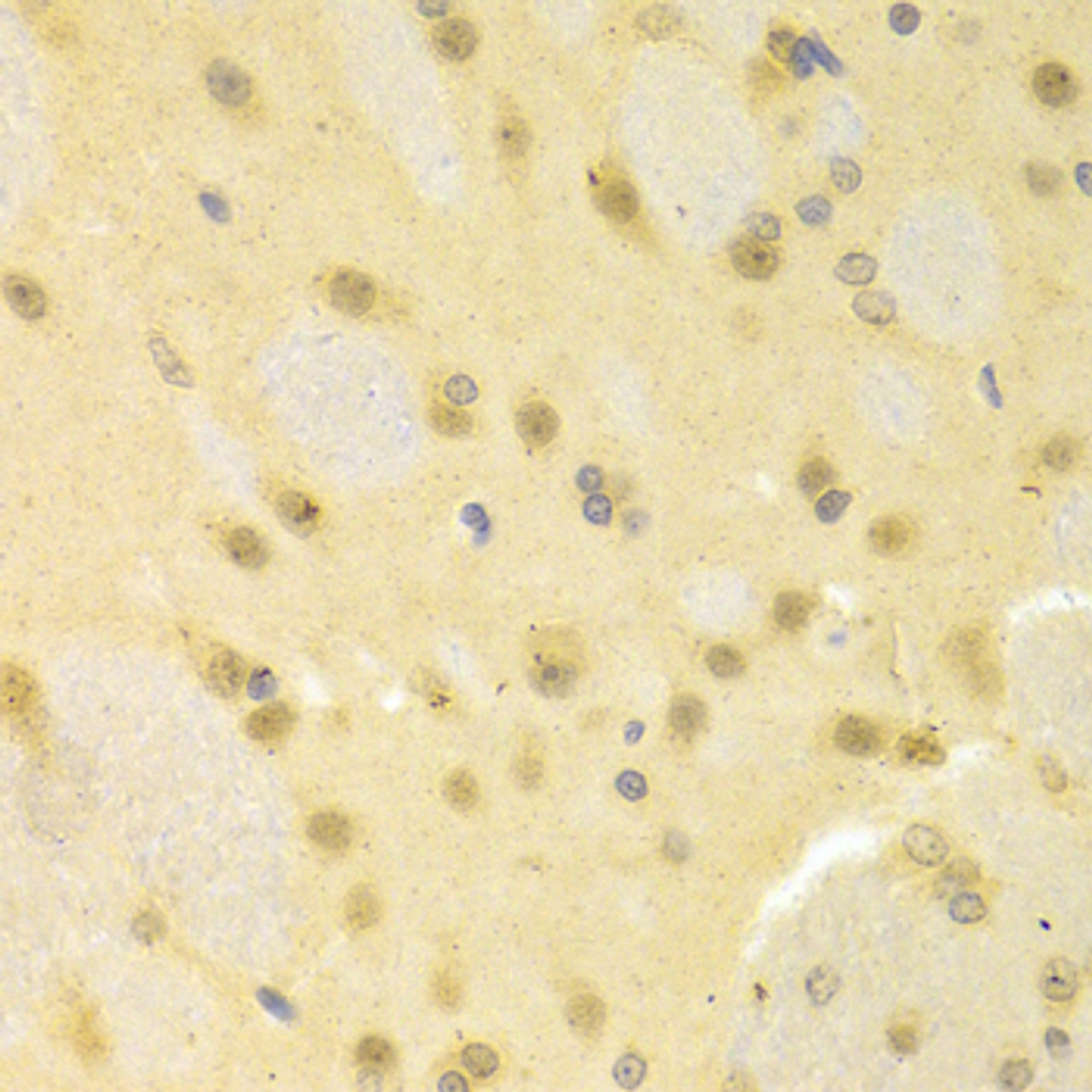 Immunohistochemistry of paraffin-embedded rat brain using SMAD1 antibody (13-881) at dilution of 1:100 (40x lens) .