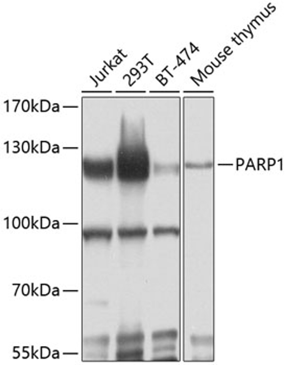 Western blot analysis of extracts of various cell lines, using PARP1 antibody (13-882) at 1:1000 dilution.<br/>Secondary antibody: HRP Goat Anti-Rabbit IgG (H+L) at 1:10000 dilution.<br/>Lysates/proteins: 25ug per lane.<br/>Blocking buffer: 3% nonfat dry milk in TBST.<br/>Detection: ECL Enhanced Kit.<br/>Exposure time: 20s.