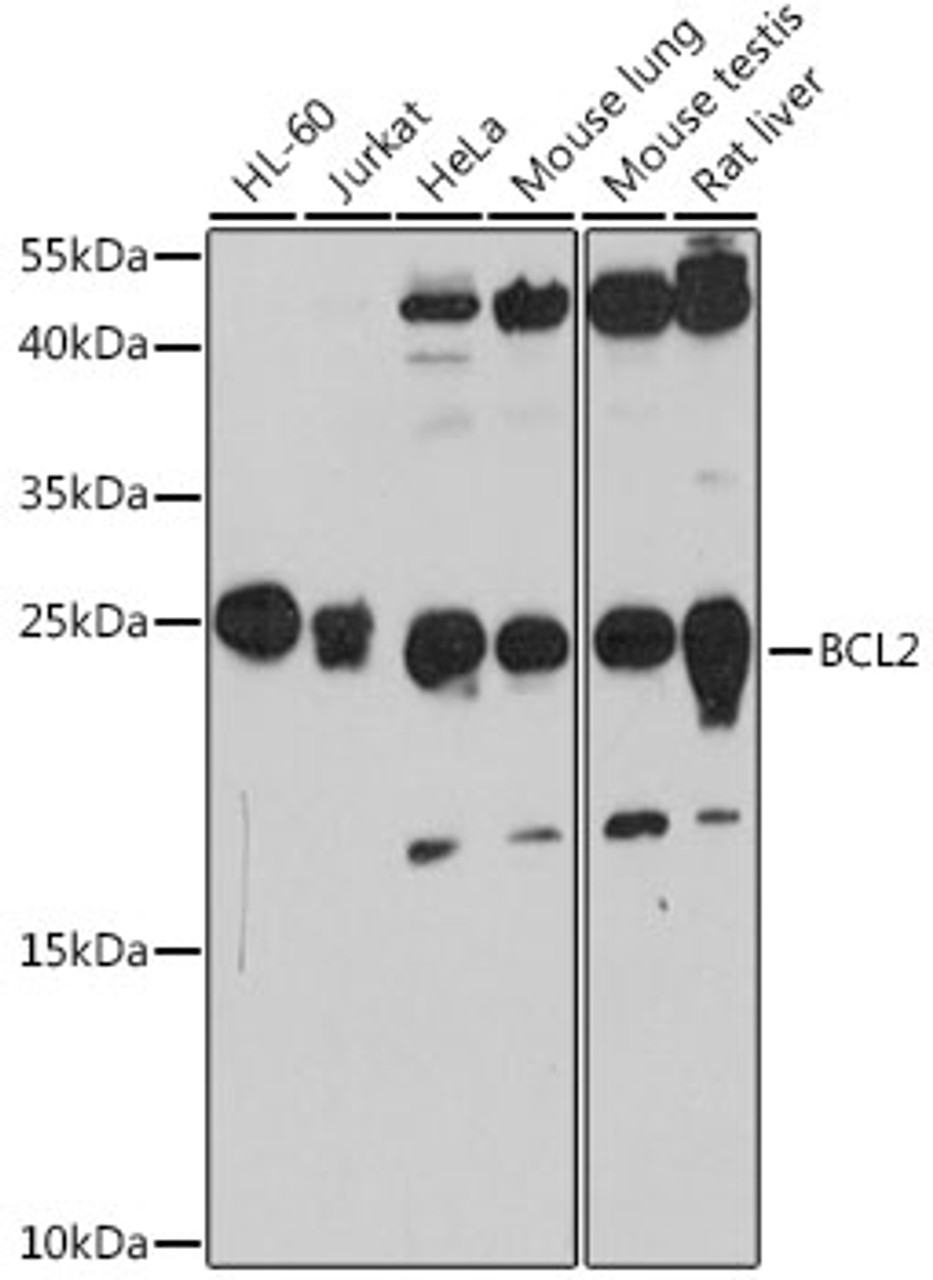 Western blot analysis of extracts of various cell lines, using BCL2 antibody (13-890) at 1:1000 dilution.<br/>Secondary antibody: HRP Goat Anti-Rabbit IgG (H+L) at 1:10000 dilution.<br/>Lysates/proteins: 25ug per lane.<br/>Blocking buffer: 3% nonfat dry milk in TBST.<br/>Detection: ECL Basic Kit.<br/>Exposure time: 90s.