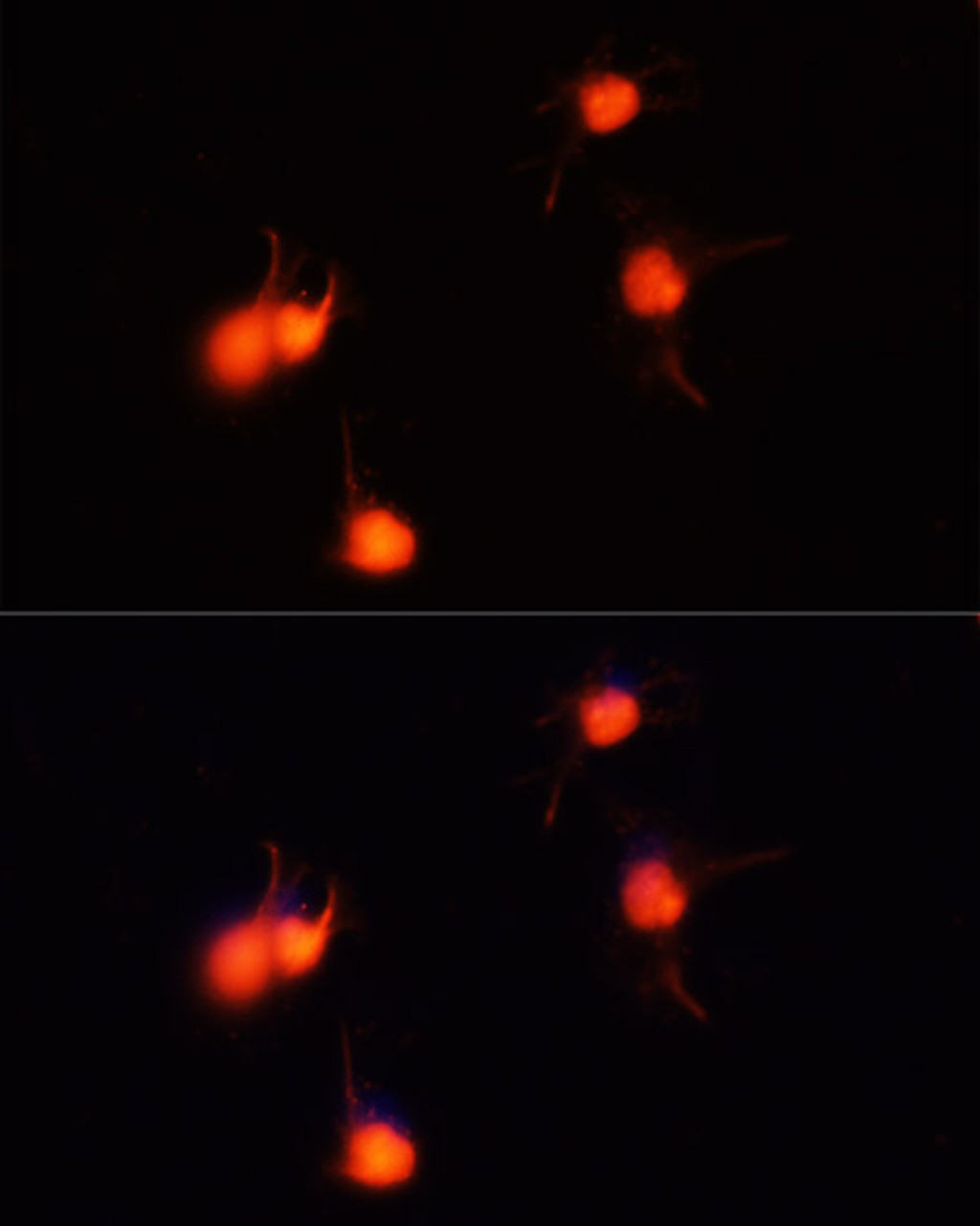 Immunofluorescence analysis of U-251MG cells using BDNF antibody (13-892) at dilution of 1:100 (40x lens) . Blue: DAPI for nuclear staining.