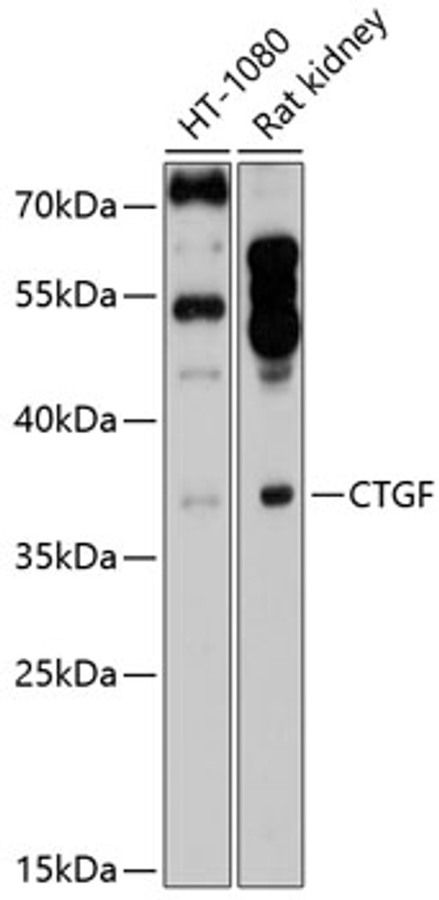 Western blot analysis of extracts of various cell lines, using CTGF antibody (13-902) at 1:1000 dilution.<br/>Secondary antibody: HRP Goat Anti-Rabbit IgG (H+L) at 1:10000 dilution.<br/>Lysates/proteins: 25ug per lane.<br/>Blocking buffer: 3% nonfat dry milk in TBST.<br/>Detection: ECL Enhanced Kit.<br/>Exposure time: 30s.