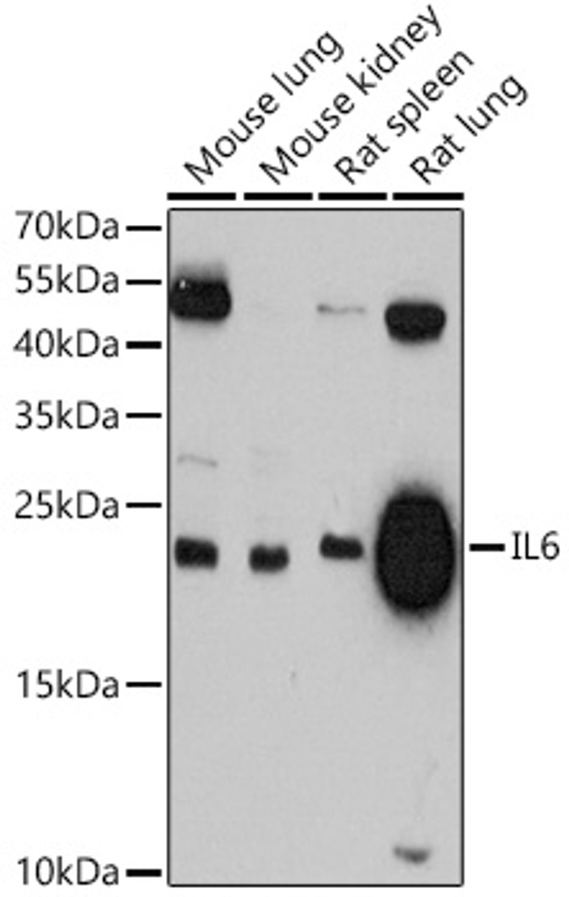 Western blot analysis of extracts of various cell lines, using IL6 antibody (13-918) at 1:3000 dilution.<br/>Secondary antibody: HRP Goat Anti-Rabbit IgG (H+L) at 1:10000 dilution.<br/>Lysates/proteins: 25ug per lane.<br/>Blocking buffer: 3% nonfat dry milk in TBST.<br/>Detection: ECL Basic Kit.<br/>Exposure time: 90s.