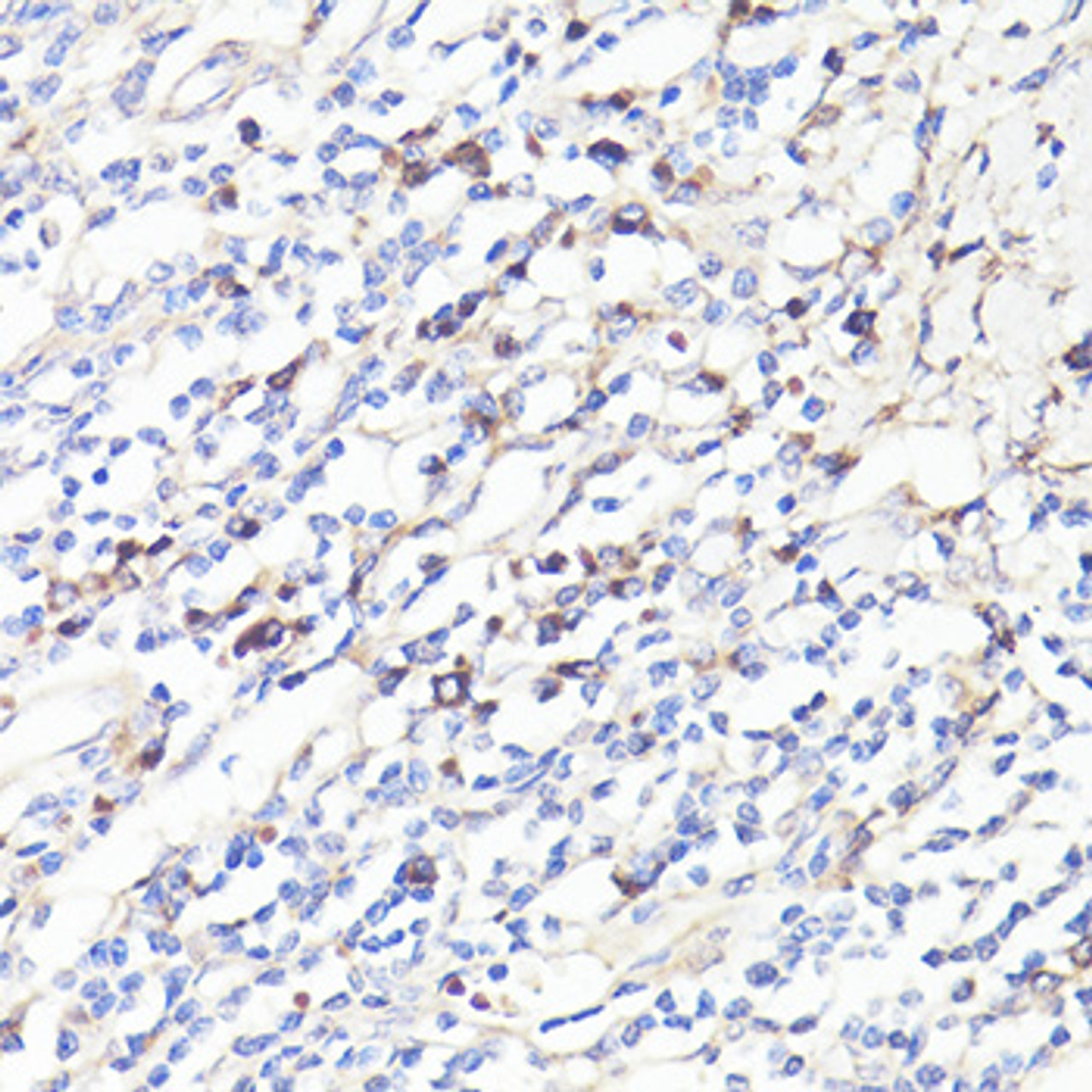 Immunohistochemistry of paraffin-embedded human tonsil using IL6 antibody (13-918) at dilution of 1:100 (40x lens) .