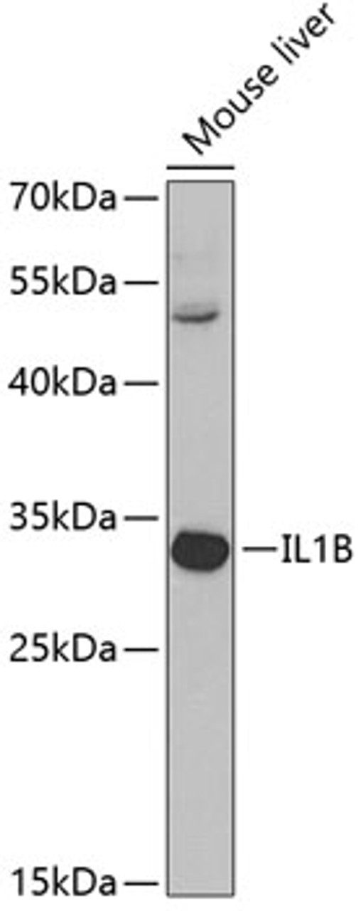 Western blot analysis of extracts of mouse liver, using IL1B antibody (13-921) at 1:1000 dilution.<br/>Secondary antibody: HRP Goat Anti-Rabbit IgG (H+L) at 1:10000 dilution.<br/>Lysates/proteins: 25ug per lane.<br/>Blocking buffer: 3% nonfat dry milk in TBST.