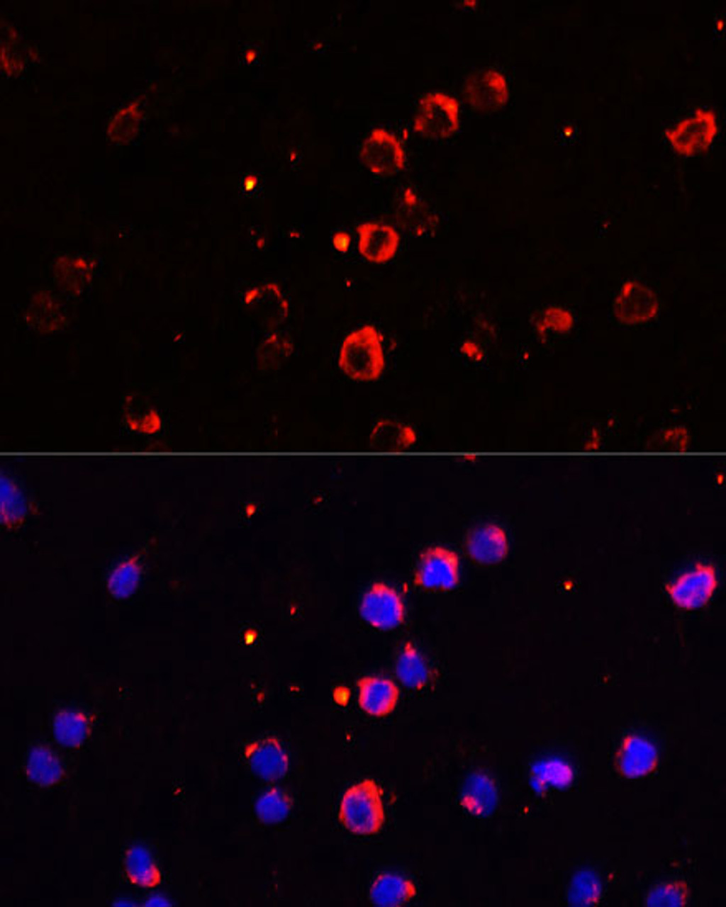 Immunofluorescence analysis of THP-1 cells using IL1B Polyclonal Antibody (13-921) at dilution of 1:100 (40x lens) . Blue: DAPI for nuclear staining.