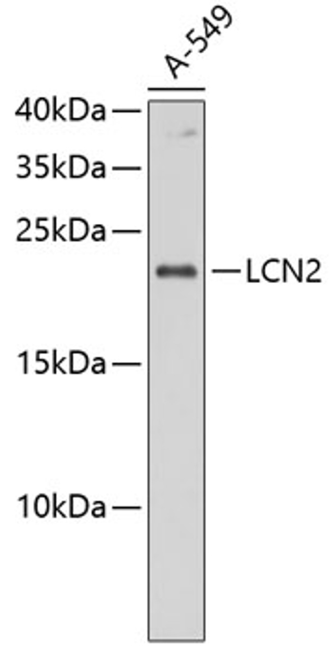 Western blot analysis of extracts of A-549 cells, using LCN2 antibody (13-925) at 1:1000 dilution.<br/>Secondary antibody: HRP Goat Anti-Rabbit IgG (H+L) at 1:10000 dilution.<br/>Lysates/proteins: 25ug per lane.<br/>Blocking buffer: 3% nonfat dry milk in TBST.<br/>Detection: ECL Basic Kit.<br/>Exposure time: 10s.