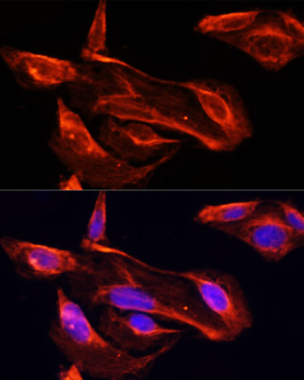 Immunofluorescence analysis of U2OS cells using MMP2 antibody (13-931) at dilution of 1:100. Blue: DAPI for nuclear staining.