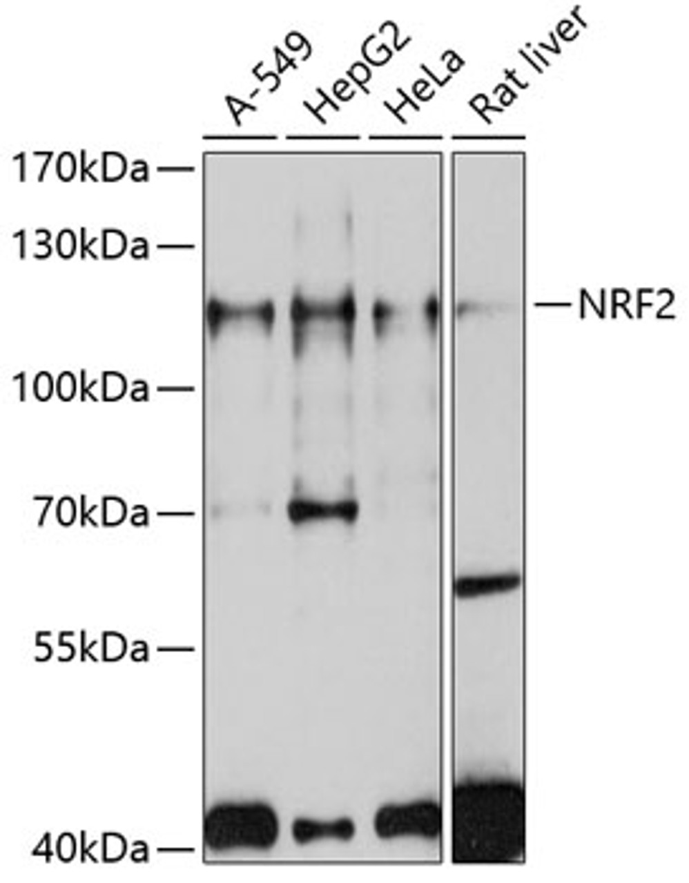 Western blot analysis of extracts of various cell lines, using NRF2 antibody (13-937) at 1:1000 dilution.<br/>Secondary antibody: HRP Goat Anti-Rabbit IgG (H+L) at 1:10000 dilution.<br/>Lysates/proteins: 25ug per lane.<br/>Blocking buffer: 3% nonfat dry milk in TBST.<br/>Detection: ECL Basic Kit.<br/>Exposure time: 10s.