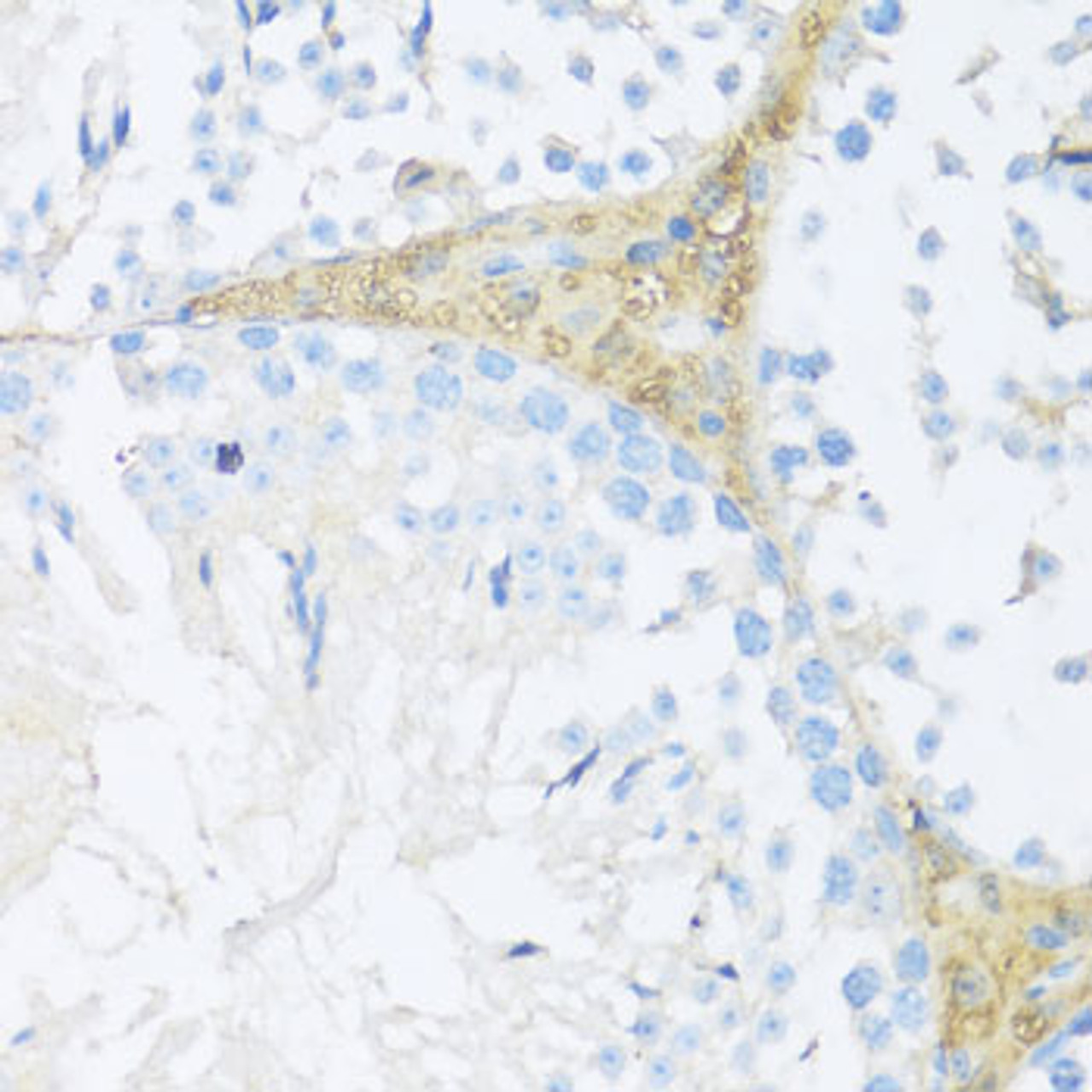 Immunohistochemistry of paraffin-embedded mouse leydig cells using NRF2 antibody (13-937) at dilution of 1:100 (40x lens) .