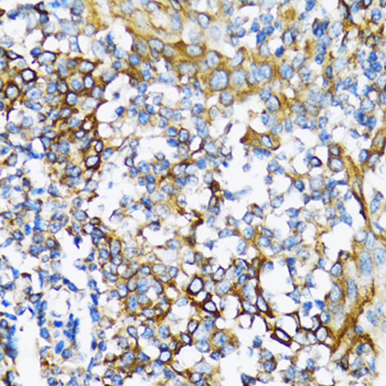 Immunohistochemistry of paraffin-embedded human tonsil using NFKB1 antibody (13-939) at dilution of 1:100 (40x lens) .