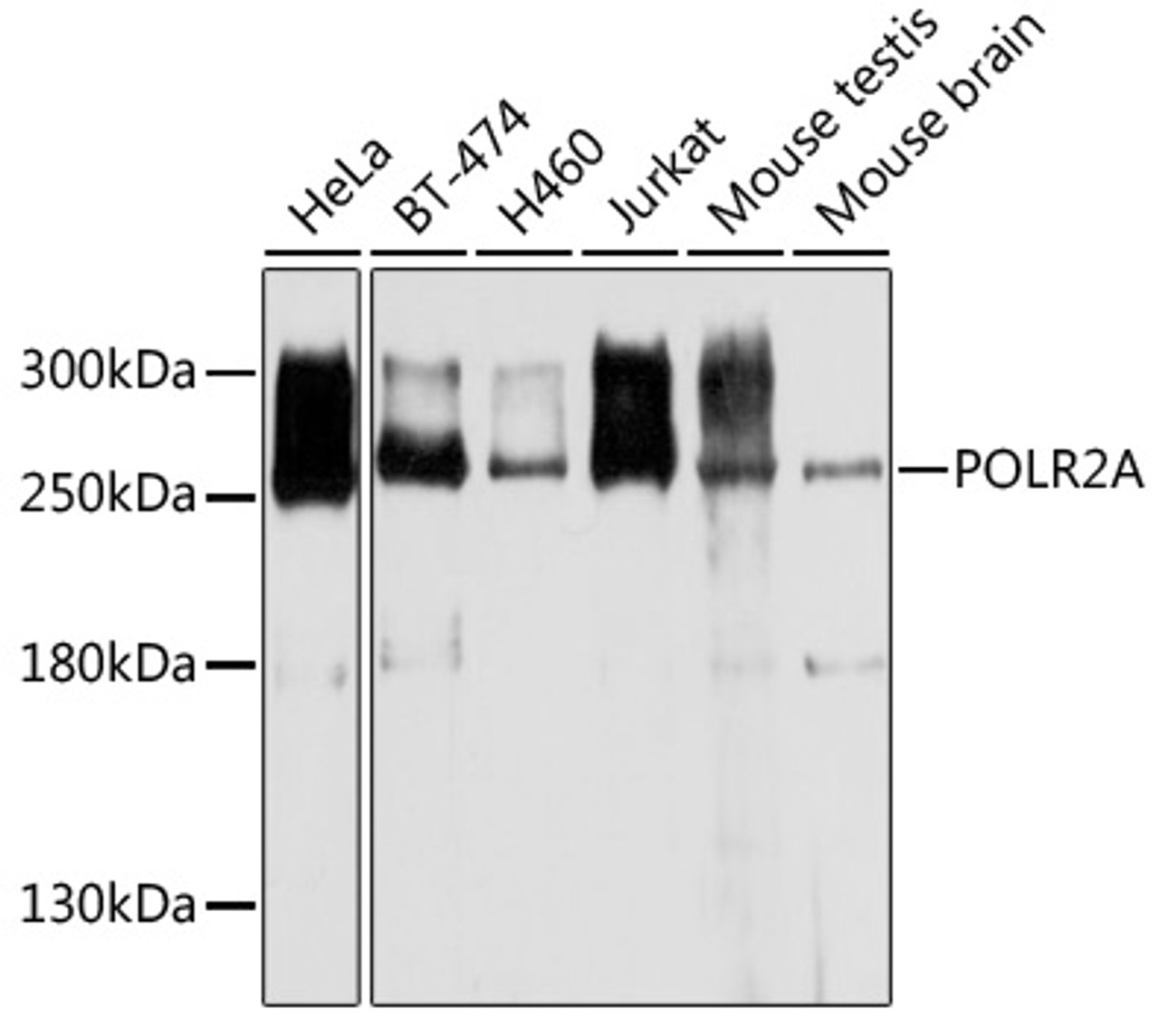 Western blot analysis of extracts of various cell lines, using POLR2A antibody (13-946) at 1:1000 dilution.<br/>Secondary antibody: HRP Goat Anti-Rabbit IgG (H+L) at 1:10000 dilution.<br/>Lysates/proteins: 25ug per lane.<br/>Blocking buffer: 3% nonfat dry milk in TBST.<br/>Detection: ECL Enhanced Kit.<br/>Exposure time: 30s.