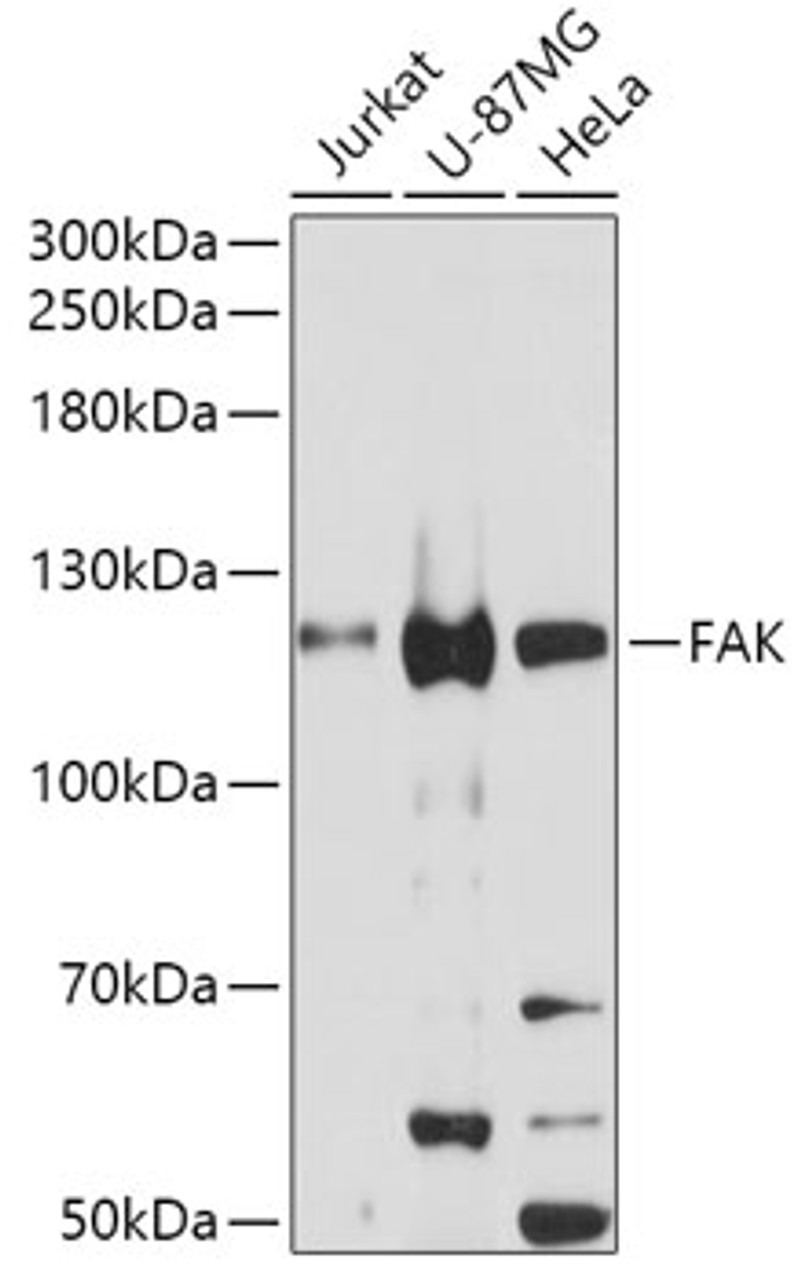 Western blot analysis of extracts of various cell lines, using PTK2 antibody (13-952) at 1:1000 dilution.<br/>Secondary antibody: HRP Goat Anti-Rabbit IgG (H+L) at 1:10000 dilution.<br/>Lysates/proteins: 25ug per lane.<br/>Blocking buffer: 3% nonfat dry milk in TBST.<br/>Detection: ECL Basic Kit.<br/>Exposure time: 60s.