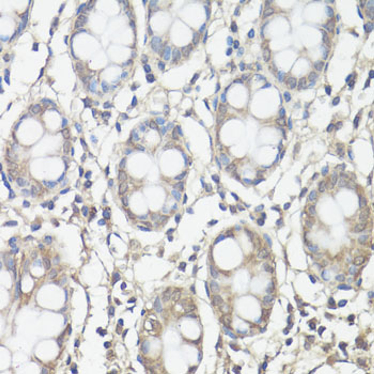 Immunohistochemistry of paraffin-embedded human colon using FAK antibody (13-952) at dilution of 1:100 (40x lens) .