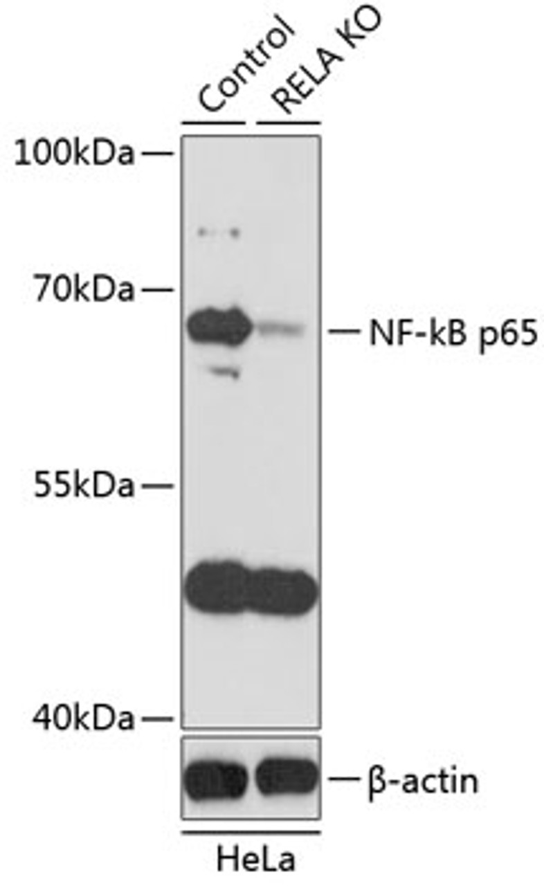 Western blot analysis of extracts from normal (control) and NF-kB p65 knockout (KO) HeLa cells, using NF-kB p65 antibody (13-953) at 1:1000 dilution.<br/>Secondary antibody: HRP Goat Anti-Rabbit IgG (H+L) at 1:10000 dilution.<br/>Lysates/proteins: 25ug per lane.<br/>Blocking buffer: 3% nonfat dry milk in TBST.<br/>Detection: ECL Basic Kit.<br/>Exposure time: 30s.