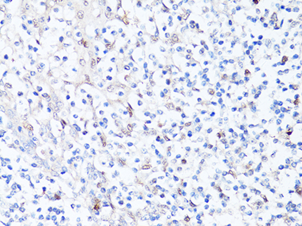 Immunohistochemistry of paraffin-embedded human tonsil using SQSTM1 / p62 antibody (13-962) at dilution of 1:100 (40x lens) .