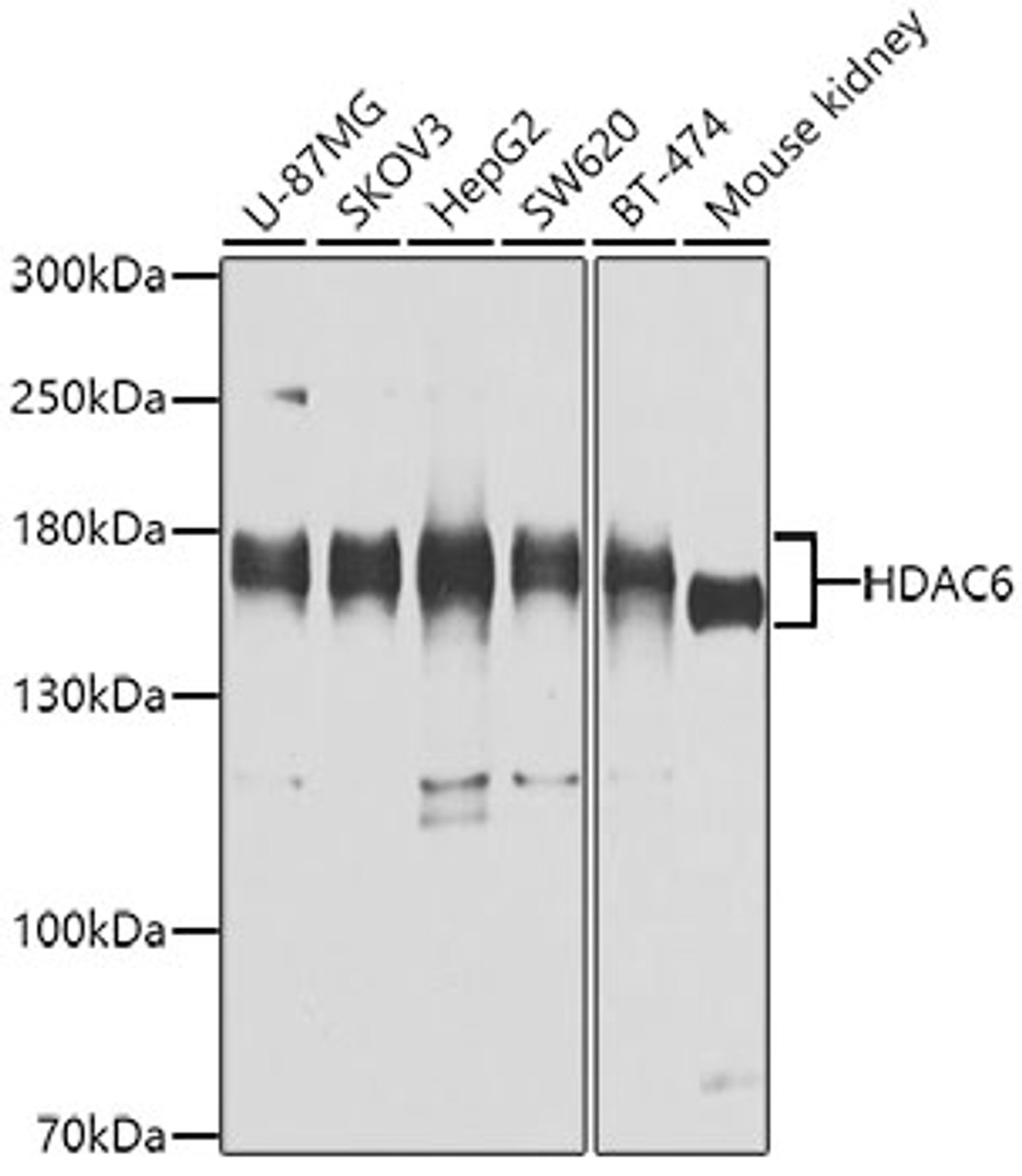 Western blot analysis of extracts of various cell lines, using HDAC6 antibody (13-963) at 1:1000 dilution.<br/>Secondary antibody: HRP Goat Anti-Rabbit IgG (H+L) at 1:10000 dilution.<br/>Lysates/proteins: 25ug per lane.<br/>Blocking buffer: 3% nonfat dry milk in TBST.<br/>Detection: ECL Basic Kit.<br/>Exposure time: 30s.