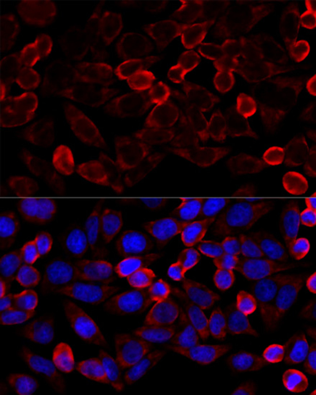 Immunofluorescence analysis of HeLa cells using HDAC6 antibody (13-963) at dilution of 1:100 (40x lens) . Blue: DAPI for nuclear staining.
