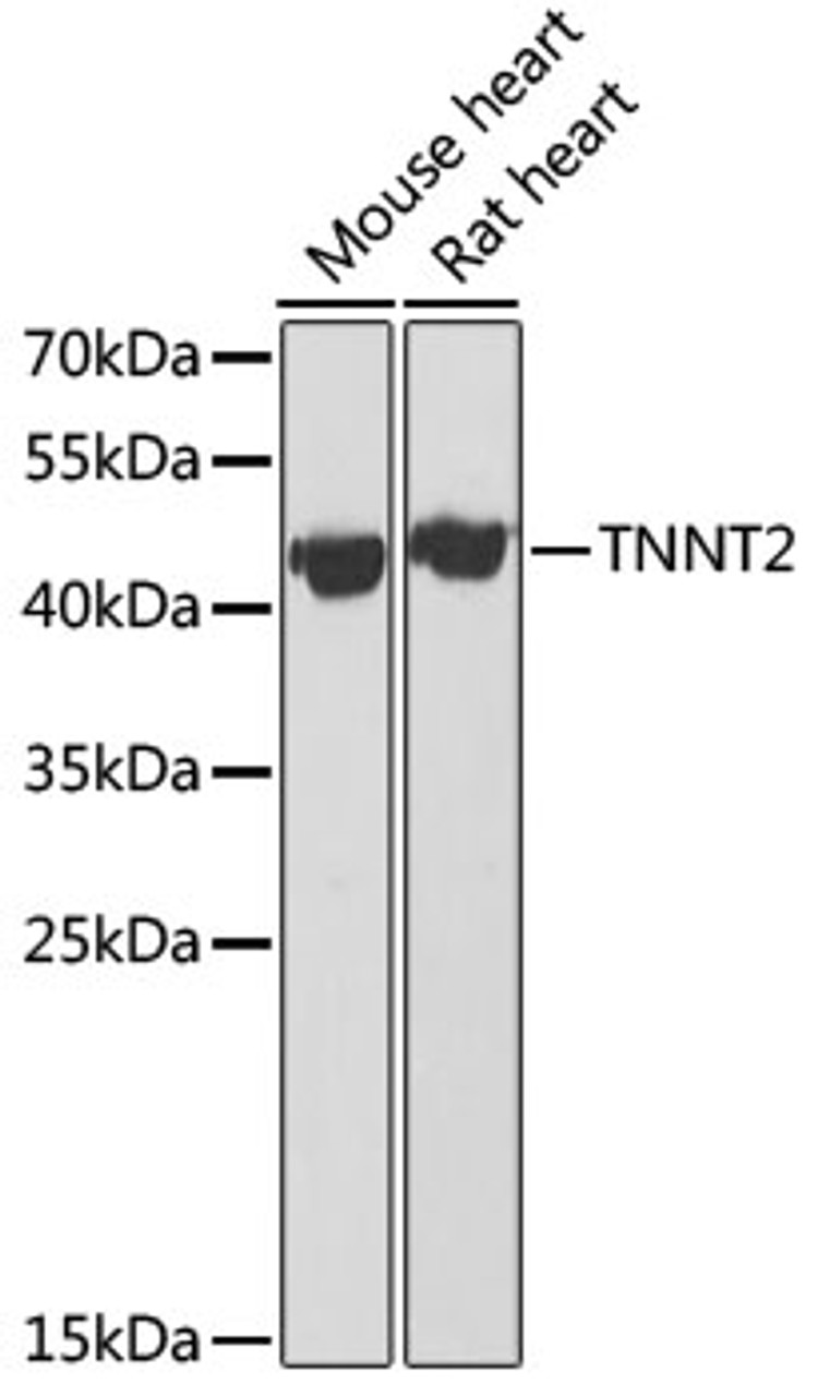 Western blot analysis of extracts of various cell lines, using TNNT2 antibody (13-964) at 1:1000 dilution.<br/>Secondary antibody: HRP Goat Anti-Rabbit IgG (H+L) at 1:10000 dilution.<br/>Lysates/proteins: 25ug per lane.<br/>Blocking buffer: 3% nonfat dry milk in TBST.<br/>Detection: ECL Basic Kit.<br/>Exposure time: 30s.
