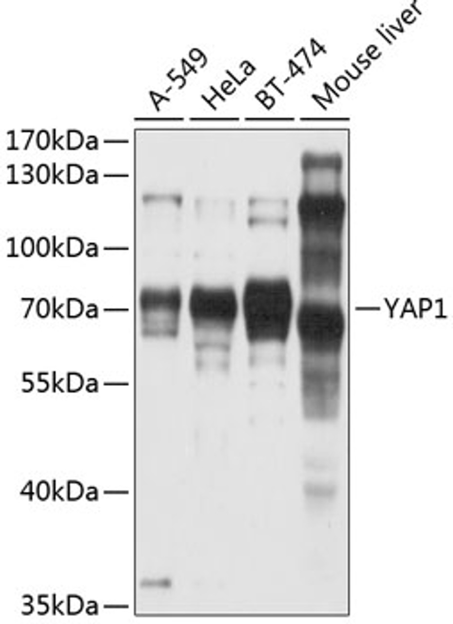 Western blot analysis of extracts of various cell lines, using YAP1 antibody (13-966) at 1:1000 dilution.<br/>Secondary antibody: HRP Goat Anti-Rabbit IgG (H+L) at 1:10000 dilution.<br/>Lysates/proteins: 25ug per lane.<br/>Blocking buffer: 3% nonfat dry milk in TBST.<br/>Detection: ECL Basic Kit.<br/>Exposure time: 10s.