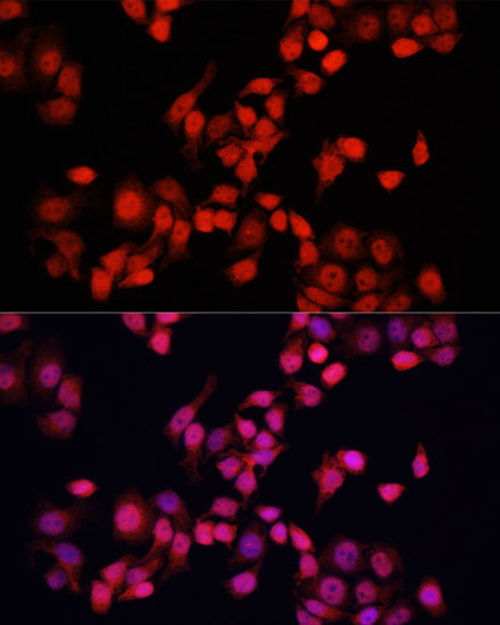 Immunofluorescence analysis of HeLa cells using YAP1 Polyclonal Antibody (13-966) at dilution of 1:100 (40x lens) . Blue: DAPI for nuclear staining.