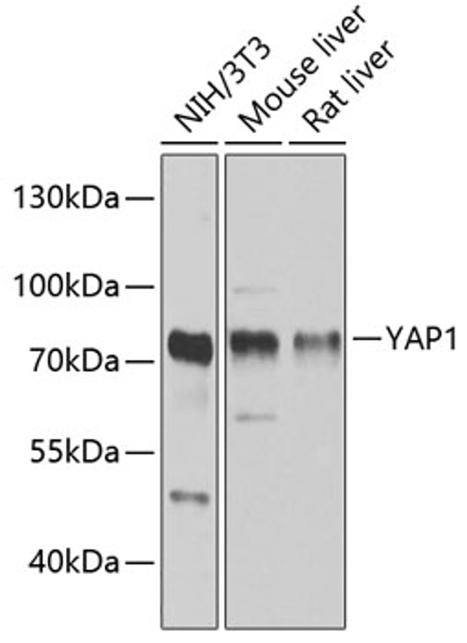 Western blot analysis of extracts of various cell lines, using YAP1 antibody (13-967) at 1:1000 dilution.<br/>Secondary antibody: HRP Goat Anti-Rabbit IgG (H+L) at 1:10000 dilution.<br/>Lysates/proteins: 25ug per lane.<br/>Blocking buffer: 3% nonfat dry milk in TBST.<br/>Detection: ECL Basic Kit.<br/>Exposure time: 60s.