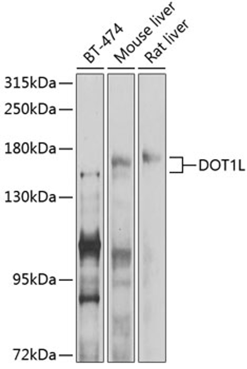 Western blot analysis of extracts of various cell lines, using DOT1L antibody (13-974) at 1:1000 dilution.<br/>Secondary antibody: HRP Goat Anti-Rabbit IgG (H+L) at 1:10000 dilution.<br/>Lysates/proteins: 25ug per lane.<br/>Blocking buffer: 3% nonfat dry milk in TBST.<br/>Detection: ECL Enhanced Kit.<br/>Exposure time: 90s.