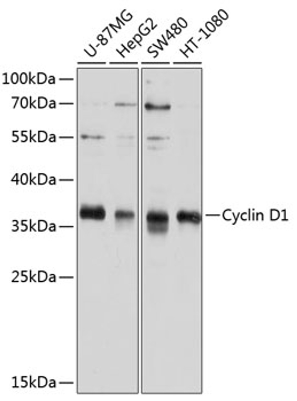 Western blot analysis of extracts of various cell lines, using Cyclin D1 antibody (13-979) at 1:1000 dilution.<br/>Secondary antibody: HRP Goat Anti-Rabbit IgG (H+L) at 1:10000 dilution.<br/>Lysates/proteins: 25ug per lane.<br/>Blocking buffer: 3% nonfat dry milk in TBST.<br/>Detection: ECL Basic Kit.<br/>Exposure time: 15s.