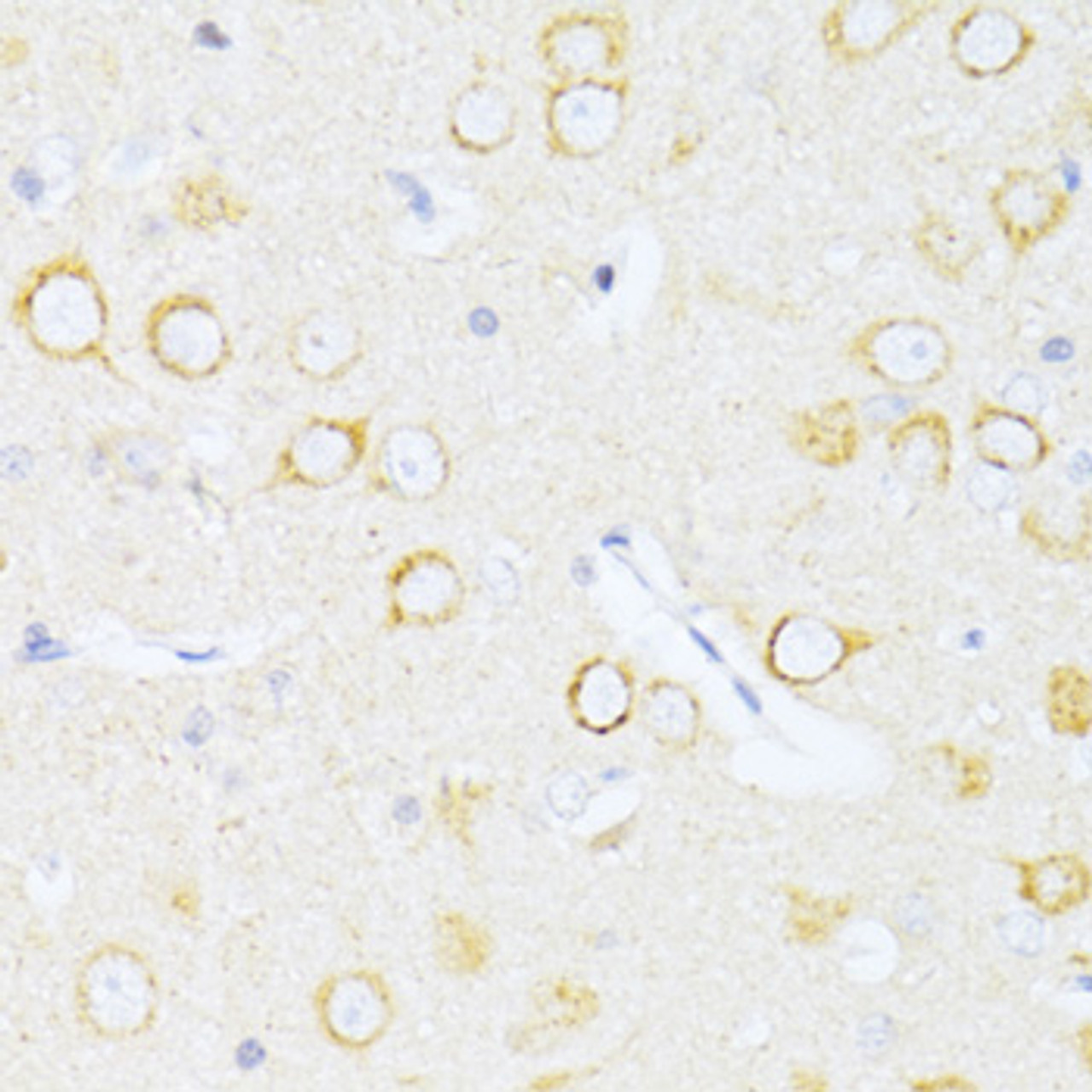 Immunohistochemistry of paraffin-embedded rat brain using Caspase 8 antibody (13-984) at dilution of 1:100 (40x lens) .