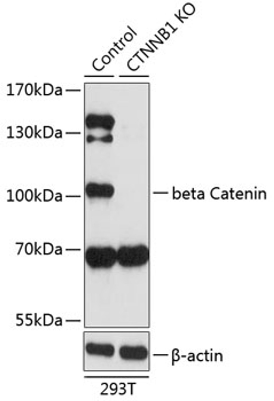 Western blot analysis of extracts from normal (control) and beta Catenin knockout (KO) 293T cells, using beta Catenin antibody (13-991) at 1:1000 dilution.<br/>Secondary antibody: HRP Goat Anti-Rabbit IgG (H+L) at 1:10000 dilution.<br/>Lysates/proteins: 25ug per lane.<br/>Blocking buffer: 3% nonfat dry milk in TBST.<br/>Detection: ECL Basic Kit.<br/>Exposure time: 90s.