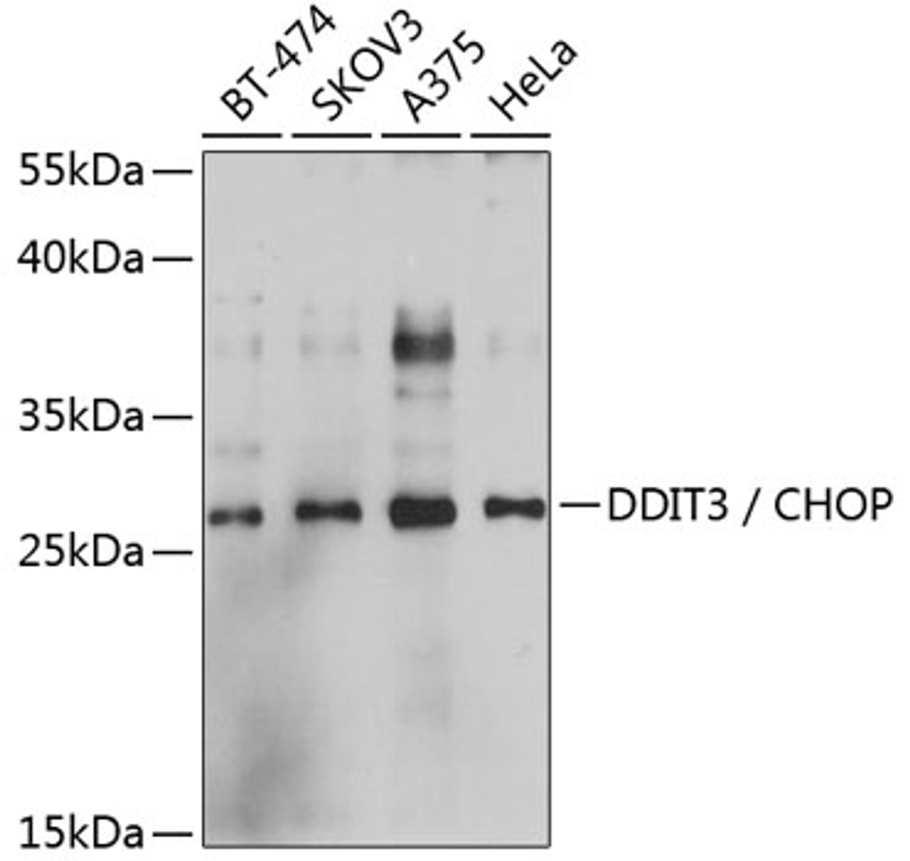 Western blot analysis of extracts of various cell lines, using DDIT3 / CHOP antibody (13-992) at 1:1000 dilution. Both C2C12 cells and C6 cells were treated by tunicamycin (2 μg/ml) for 8 hours.<br/>Secondary antibody: HRP Goat Anti-Rabbit IgG (H+L) at 1:10000 dilution.<br/>Lysates/proteins: 25ug per lane.<br/>Blocking buffer: 3% nonfat dry milk in TBST.<br/>Detection: ECL Basic Kit.<br/>Exposure time: 3min.