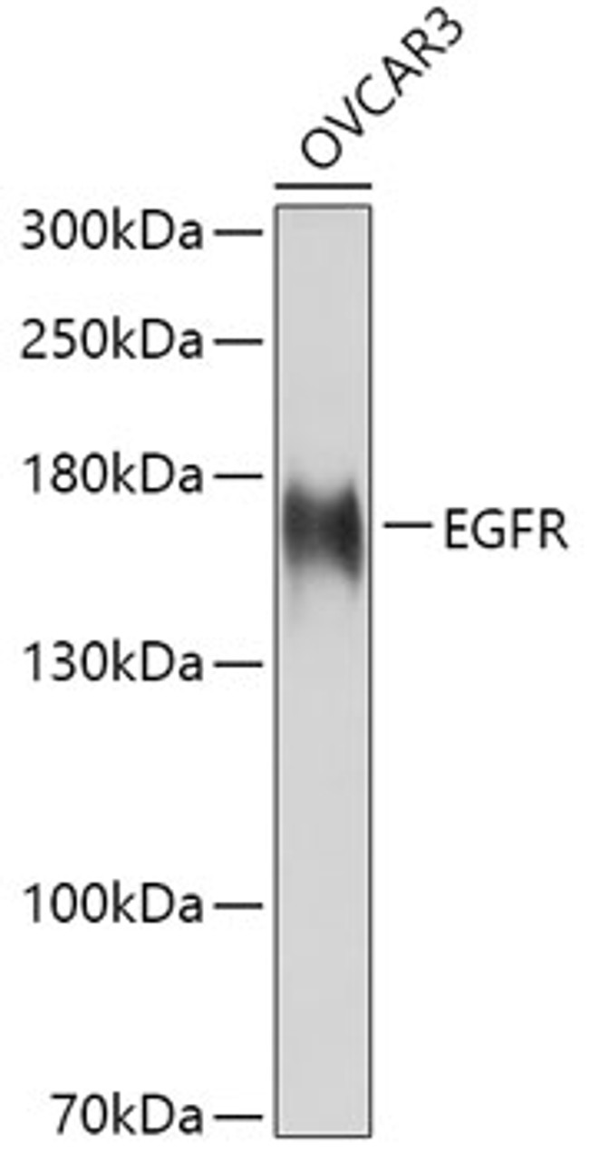 Western blot analysis of extracts of OVCAR3 cells, using EGFR antibody (13-994) at 1:3000 dilution.<br/>Secondary antibody: HRP Goat Anti-Rabbit IgG (H+L) at 1:10000 dilution.<br/>Lysates/proteins: 25ug per lane.<br/>Blocking buffer: 3% nonfat dry milk in TBST.<br/>Detection: ECL Basic Kit.<br/>Exposure time: 3s.
