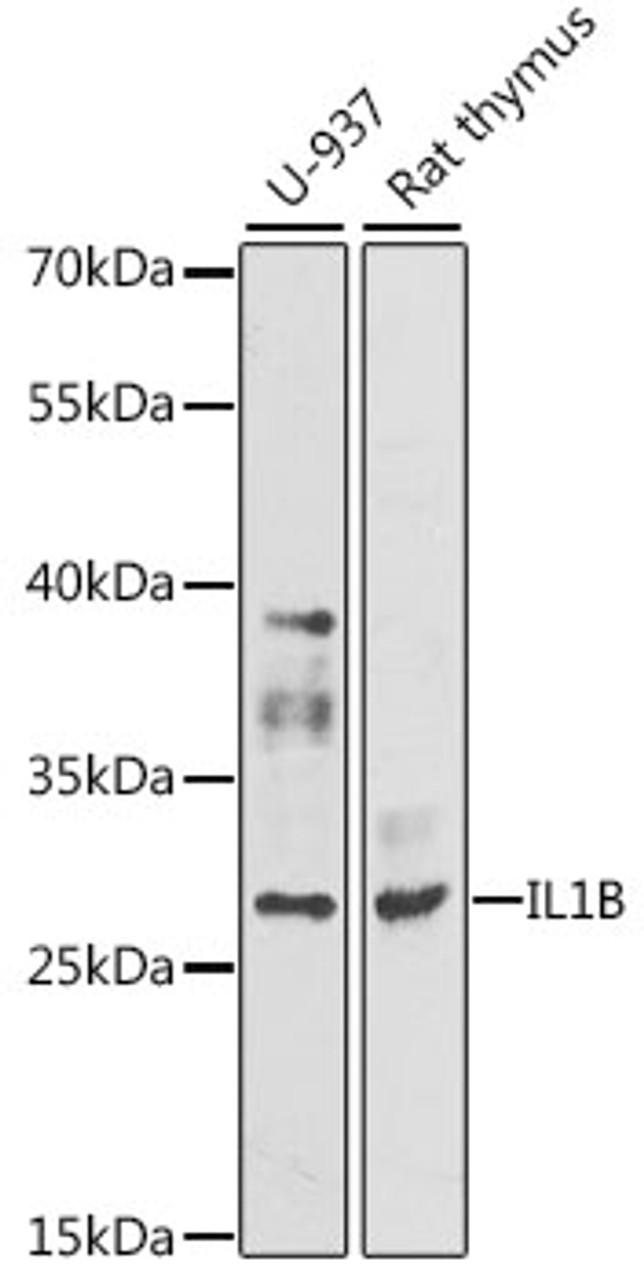 Western blot analysis of extracts of various cell lines, using IL1B antibody (14-001) .<br/>Secondary antibody: HRP Goat Anti-Rabbit IgG (H+L) at 1:10000 dilution.<br/>Lysates/proteins: 25ug per lane.<br/>Blocking buffer: 3% nonfat dry milk in TBST.