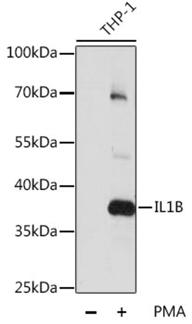 Western blot analysis of extracts of various cell lines, using IL1B antibody (14-002) at 1:1000 dilution. THP-1 cells were treated by PMA (80 nM) for overnight.<br/>Secondary antibody: HRP Goat Anti-Rabbit IgG (H+L) at 1:10000 dilution.<br/>Lysates/proteins: 25ug per lane.<br/>Blocking buffer: 3% nonfat dry milk in TBST.<br/>Detection: ECL Basic Kit.<br/>Exposure time: 5s.
