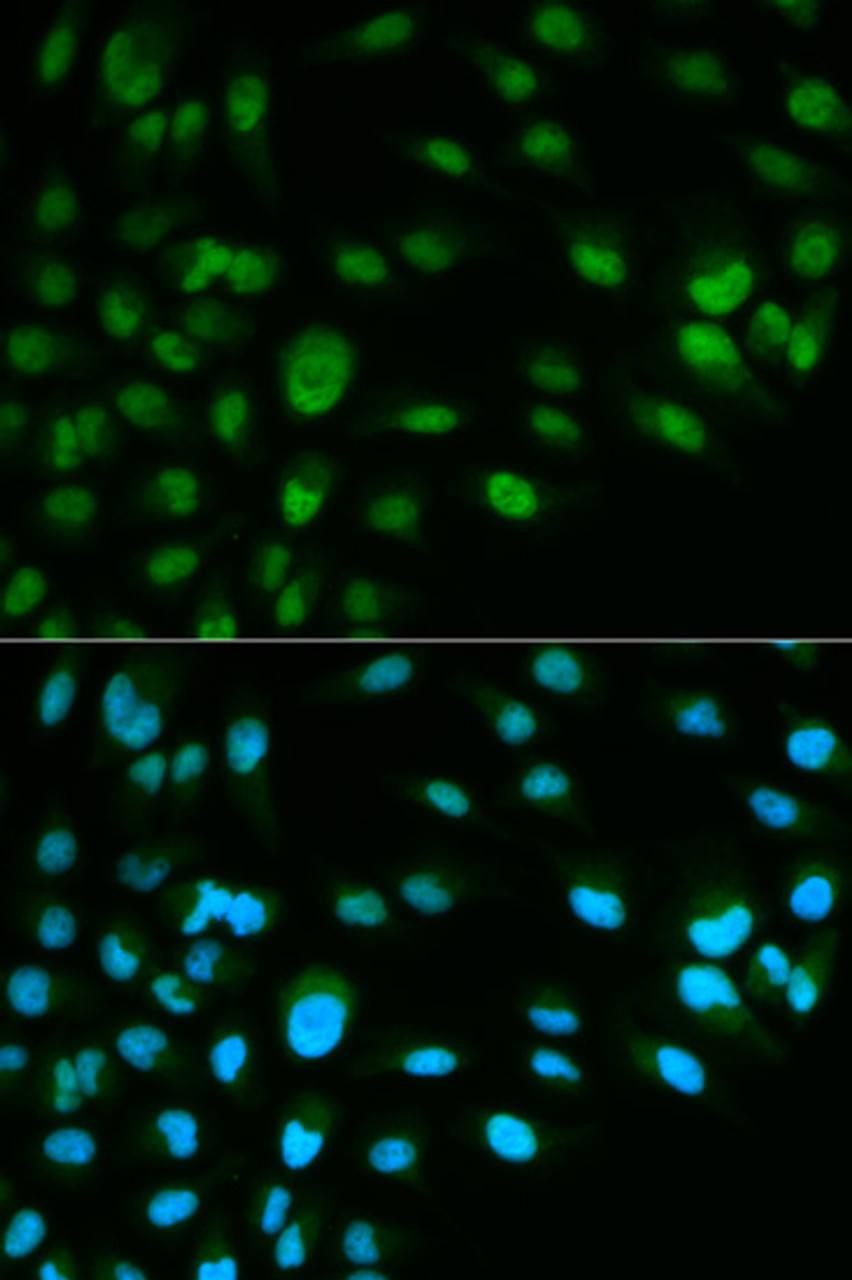 Immunofluorescence analysis of HeLa cells using MCM7 antibody (14-005) . Blue: DAPI for nuclear staining.