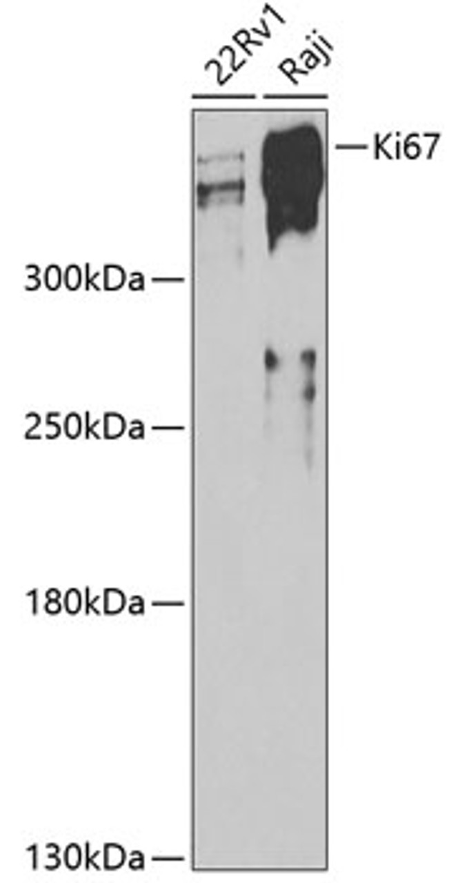 Western blot analysis of extracts of various cell lines, using Ki67 antibody (14-010) at 1:500 dilution.<br/>Secondary antibody: HRP Goat Anti-Rabbit IgG (H+L) at 1:10000 dilution.<br/>Lysates/proteins: 25ug per lane.<br/>Blocking buffer: 3% nonfat dry milk in TBST.<br/>Detection: ECL Basic Kit.<br/>Exposure time: 90s.
